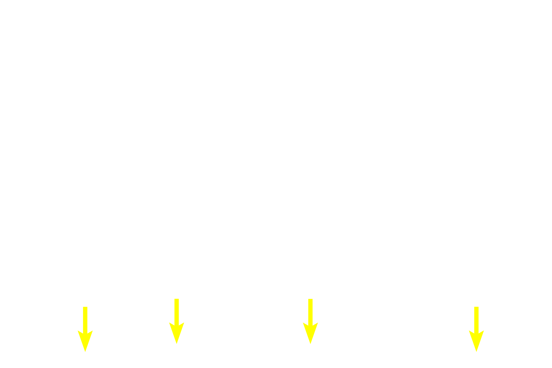 Choriocapillaris > <p>The choriocapillary layer consists of fenestrated capillaries that supply the pigment epithelium and the outer layers of the retina.  The basal laminae of these capillaries forms the outermost layer of Bruch’s membrane.</p>
