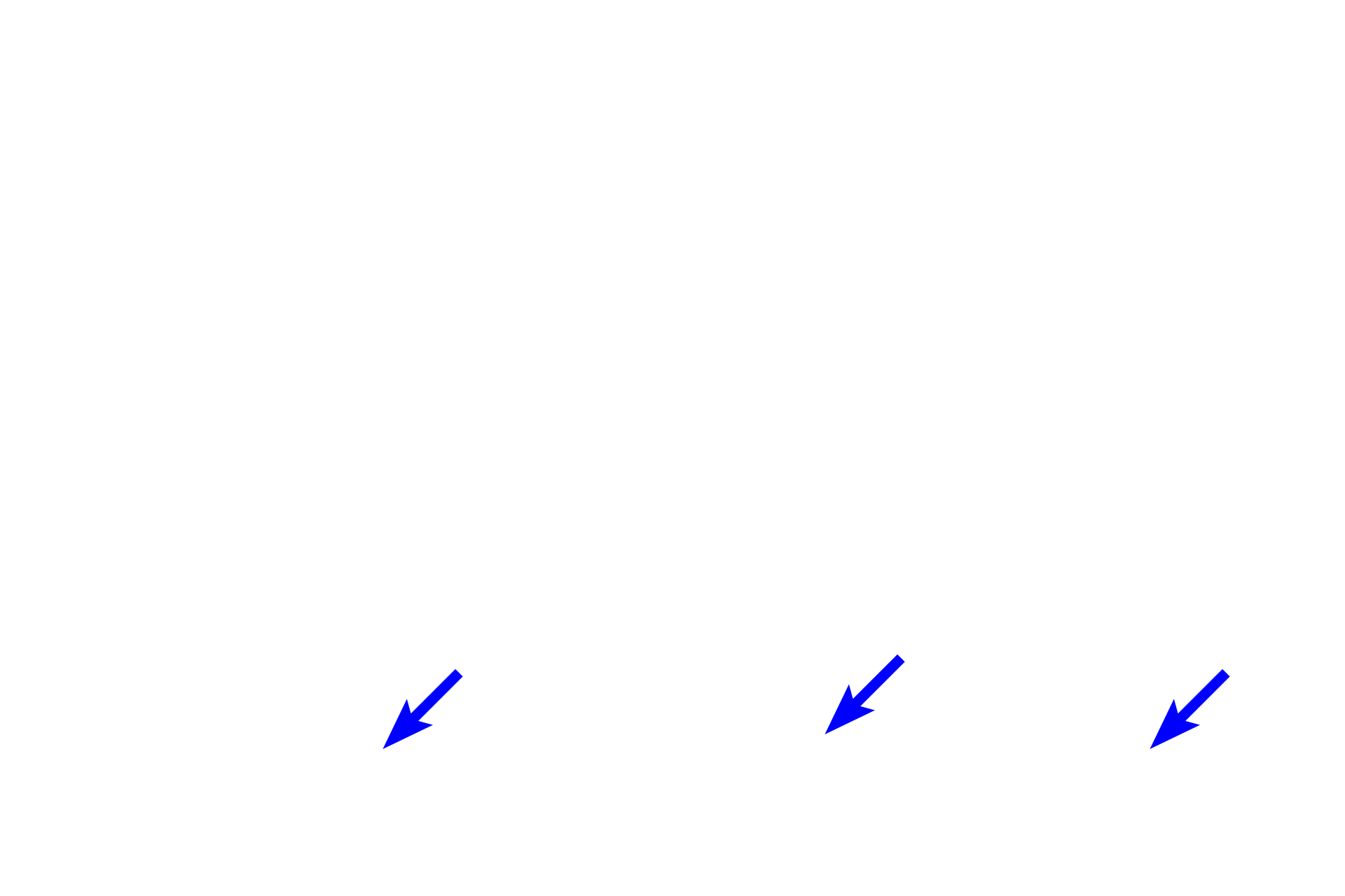  -- Outer segments > <p>The outer segment, the site of photosensitivity, contains the pigments, rhodopsin (rods) and iodopsin (cones) and is cylindrical in rods and conical in cones.</p>
