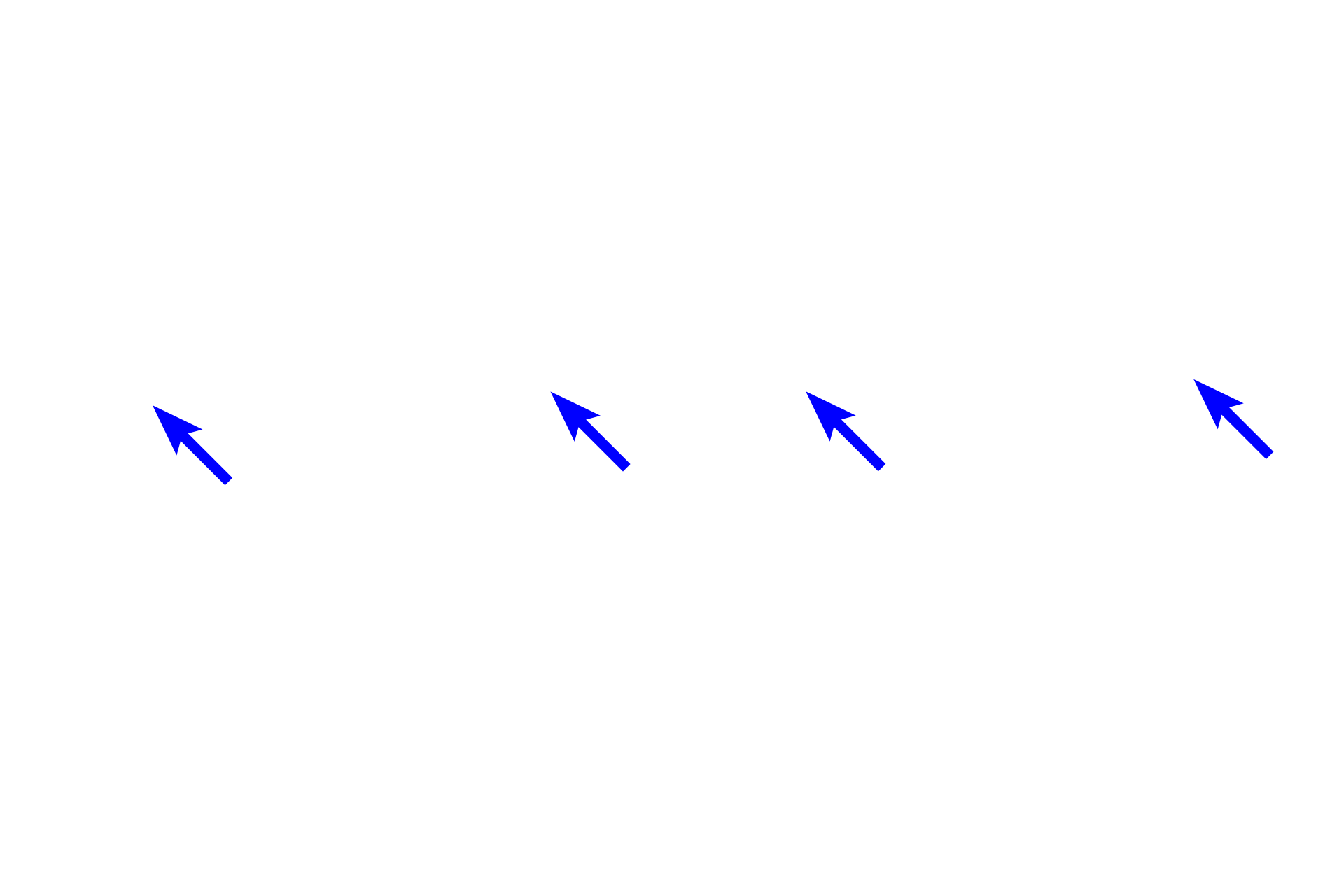  - Outer plexiform layer > <p>In the outer plexiform layer, axons of photoreceptor cells terminate on the dendrites of bipolar cells and horizontal cells.</p>
