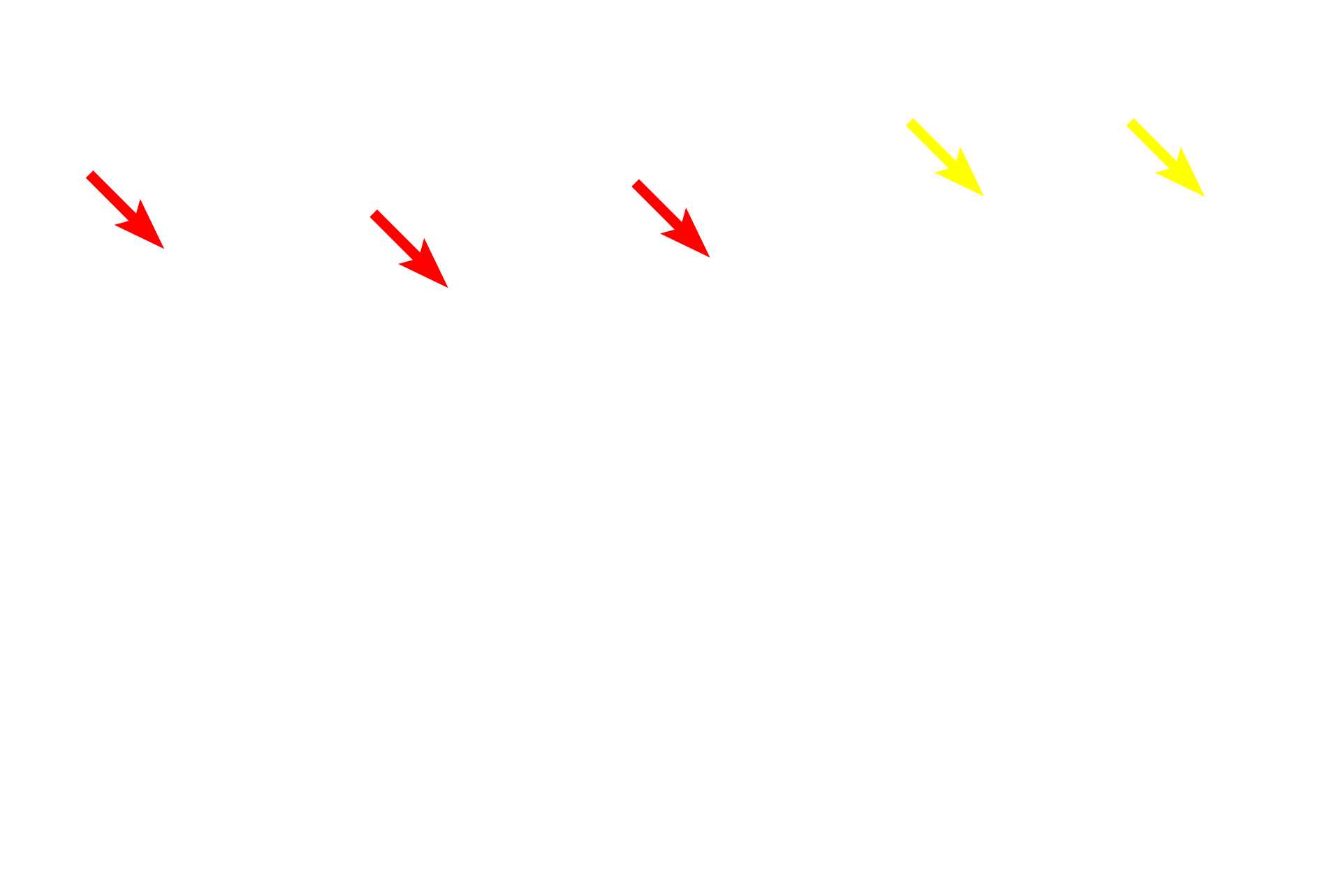 - Inner plexiform layer <p>This image compares the appearance of the retina seen by light microscopy (right) and electron microscopy (left) at a similar magnification.  400x</p>
