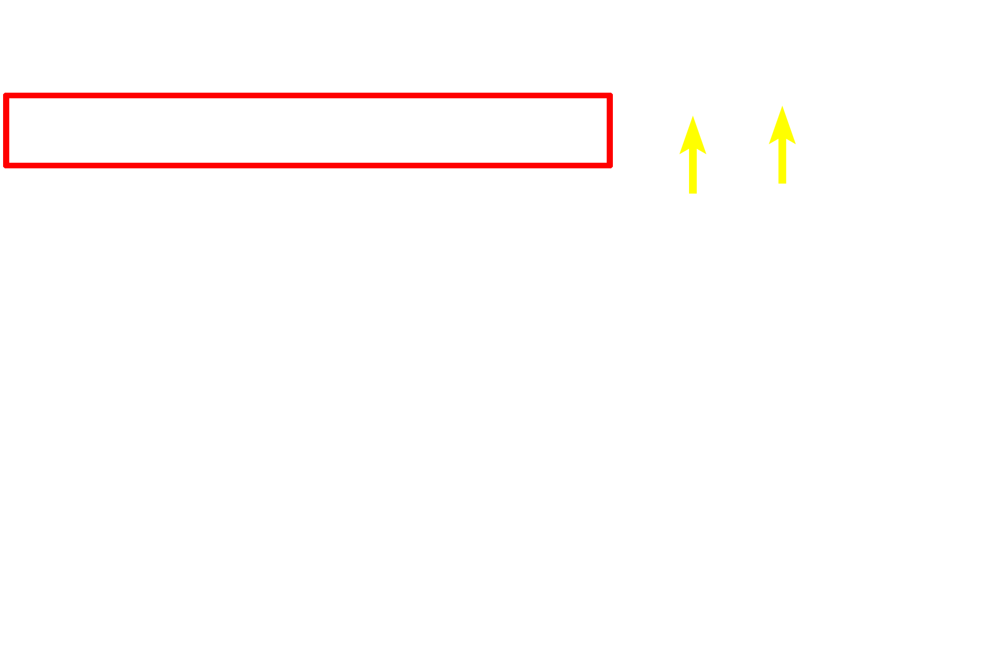  - Ganglion cell layer <p>This image compares the appearance of the retina seen by light microscopy (right) and electron microscopy (left) at a similar magnification.  400x</p>
<p>&nbsp;</p>
