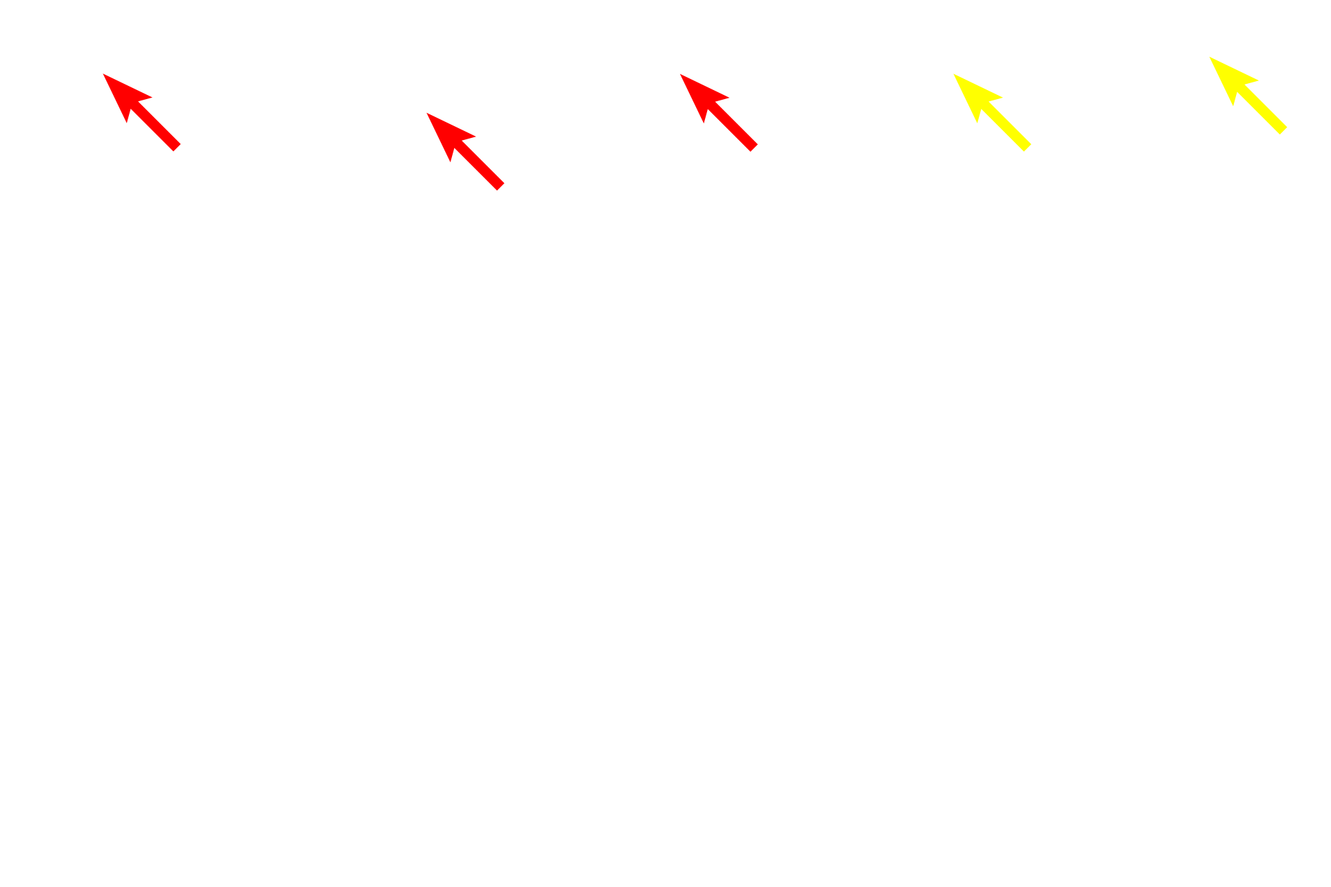  - Nerve fiber layer <p>This image compares the appearance of the retina seen by light microscopy (right) and electron microscopy (left) at a similar magnification.  400x</p>
