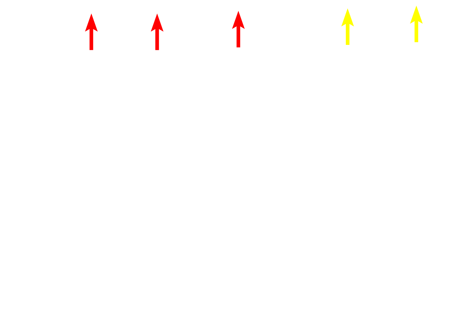  - Inner limiting membrane <p>This image compares the appearance of the retina seen by light microscopy (right) and electron microscopy (left) at a similar magnification.  400x</p>
