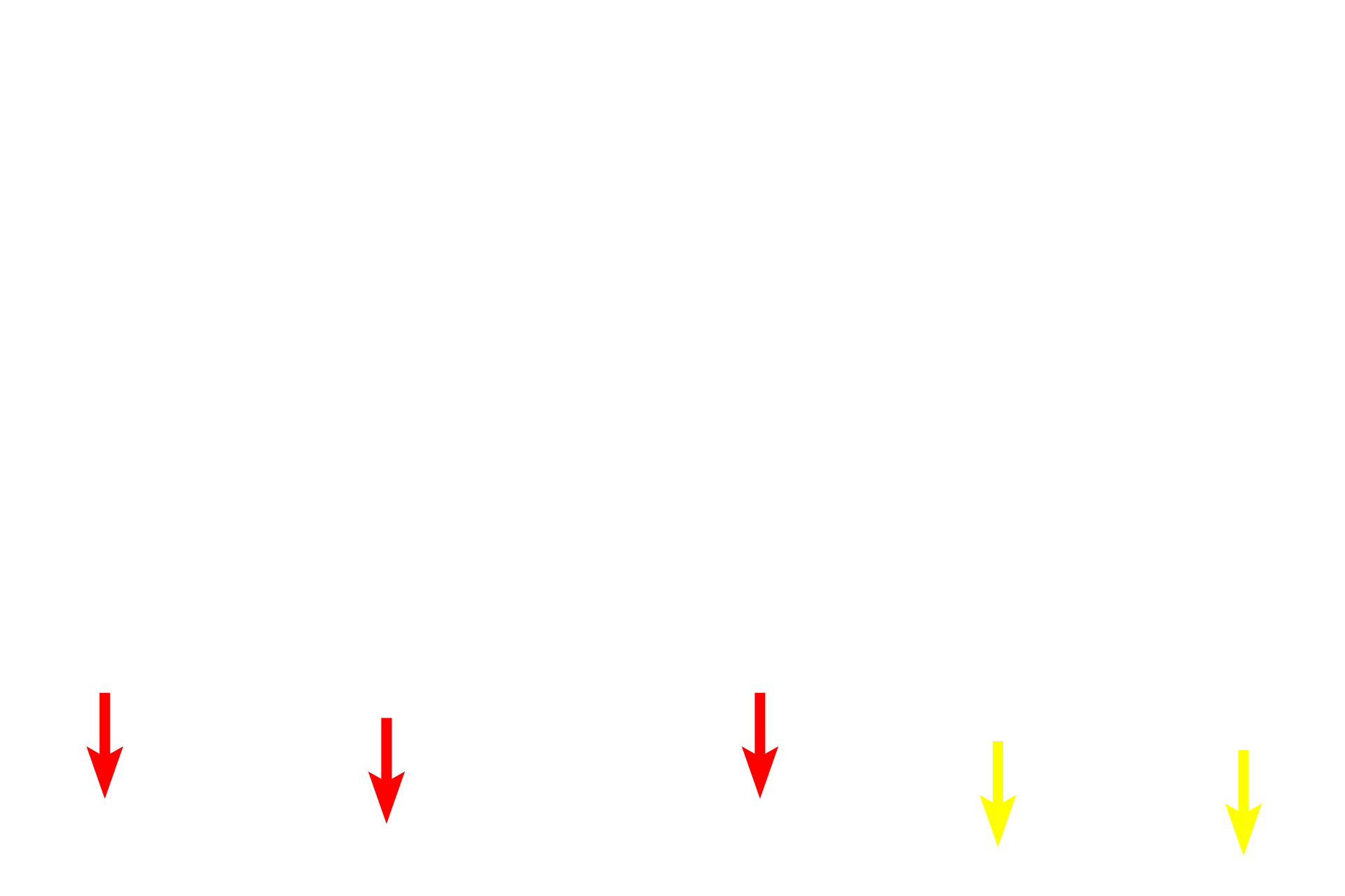 Choriocapillaris <p>This image compares the appearance of the retina seen by light microscopy (right) and electron microscopy (left) at a similar magnification.  400x</p>
