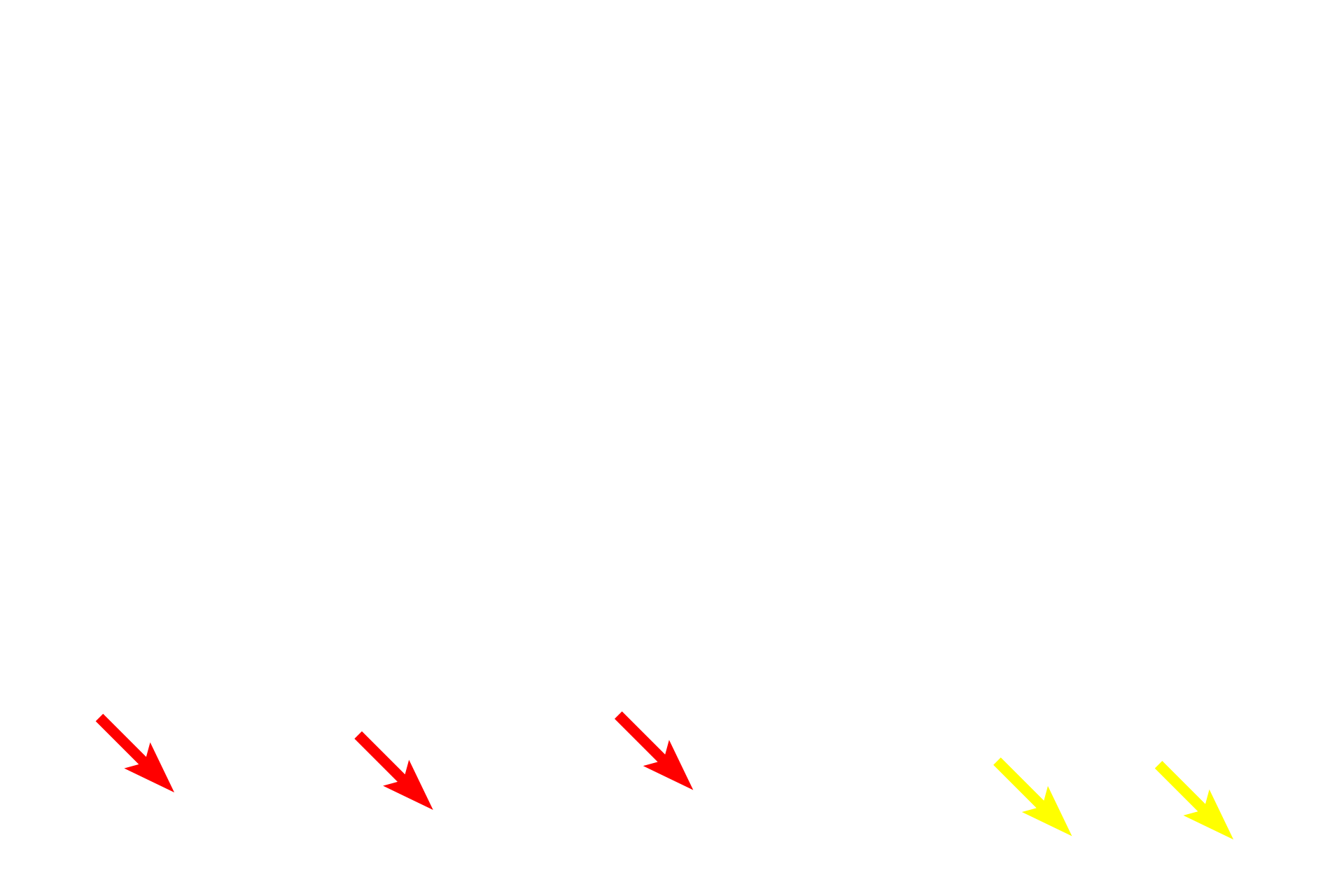 Bruch’s membrane <p>This image compares the appearance of the retina seen by light microscopy (right) and electron microscopy (left) at a similar magnification.  400x</p>
