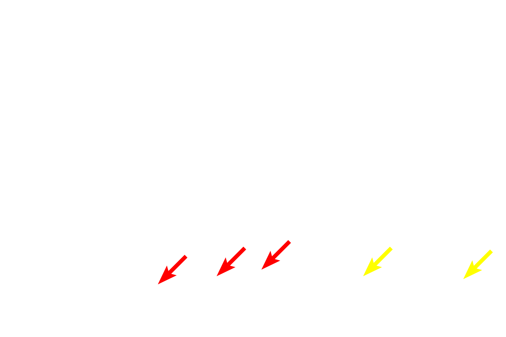  -- Outer segments of rods and cones <p>This image compares the appearance of the retina seen by light microscopy (right) and electron microscopy (left) at a similar magnification.  400x</p>
