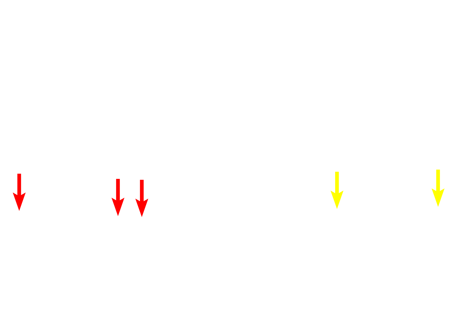  -- Outer limiting membrane <p>This image compares the appearance of the retina seen by light microscopy (right) and electron microscopy (left) at a similar magnification.  400x</p>
