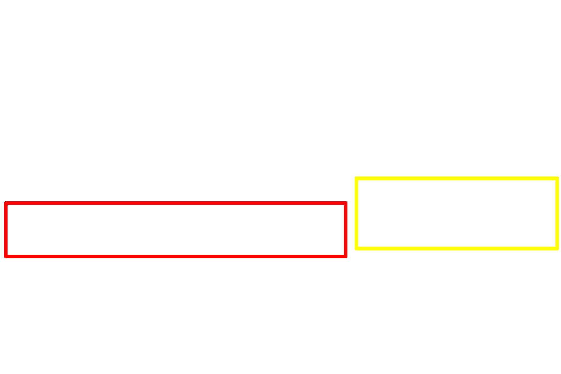  -- Outer nuclear layer <p>This image compares the appearance of the retina seen by light microscopy (right) and electron microscopy (left) at a similar magnification.  400x</p>
