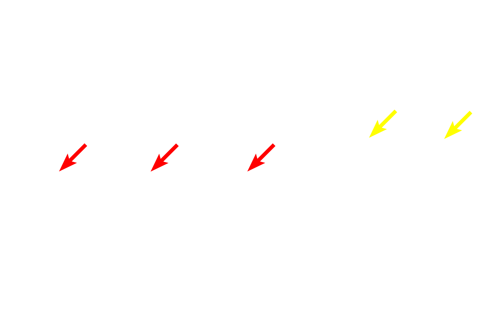  - Outer plexiform layer <p>This image compares the appearance of the retina seen by light microscopy (right) and electron microscopy (left) at a similar magnification.  400x</p>
