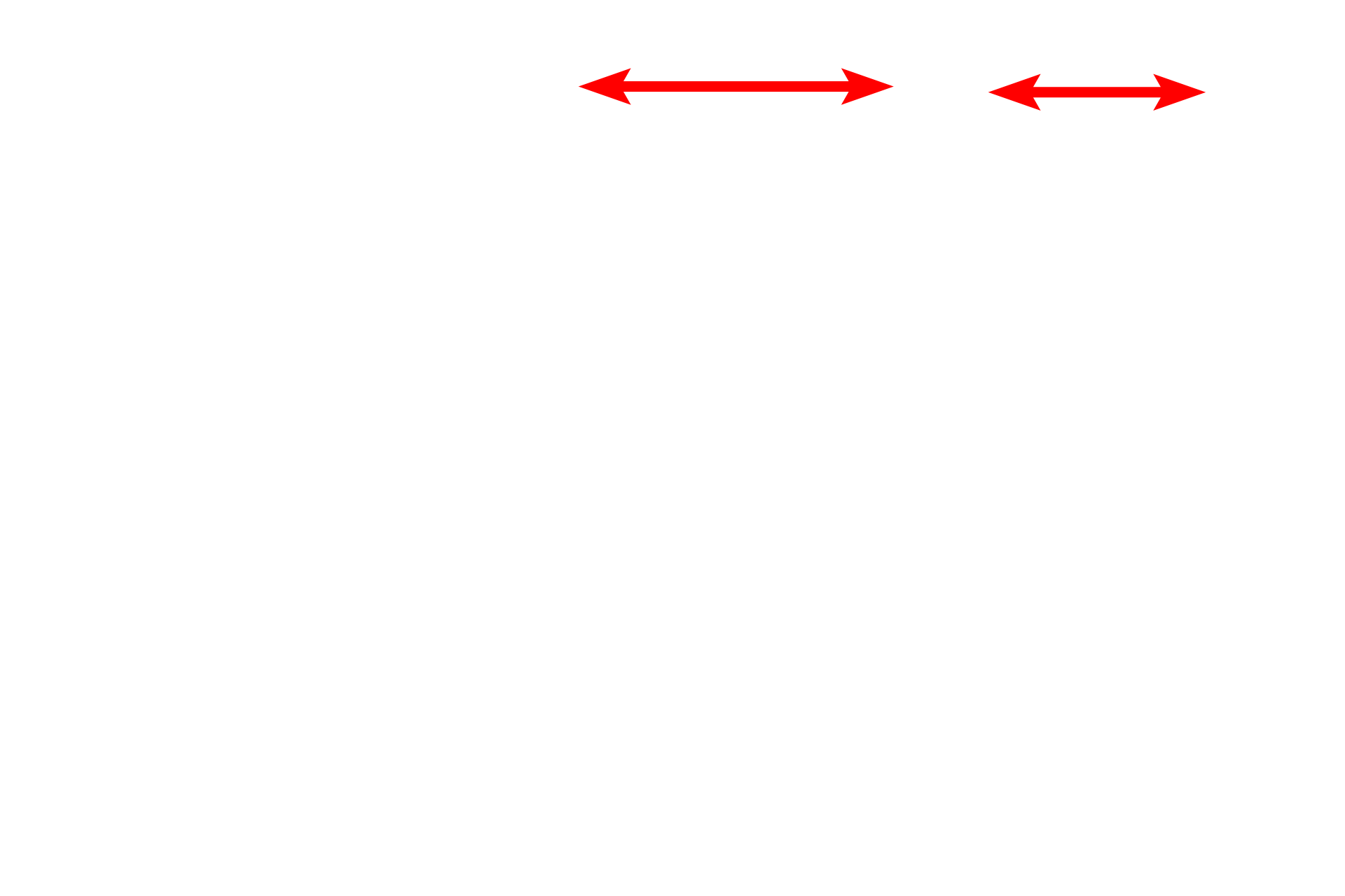 Rod outer segments <p>The photosensitive portions of rods are embedded deep in the pigment epithelium and are filled with membranous discs that contain the visual pigment, rhodopsin. These discs are formed continuously by repetitive in-folding of the plasma membrane of the rods and by synthesis of proteins in its inner segment. Discs are exfoliated distally and are phagocytosed by the pigment epithelial cells.  400x, 20,000x</p>
