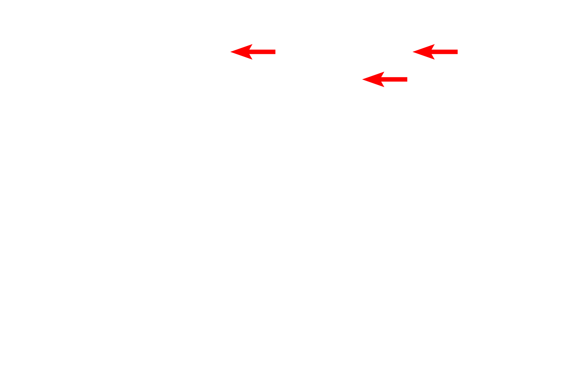  - Cell processes <p>It takes about 10 days for newly formed discs to reach the end of the outer segment, where they are shed and phagocytosed by cells of the pigmented epithelium.  Note the intact distal segment of a rod surrounded by long, thin processes of the pigment epithelium cells; packets of phagocytosed discs are visible in the epithelial cytoplasm.</p>
