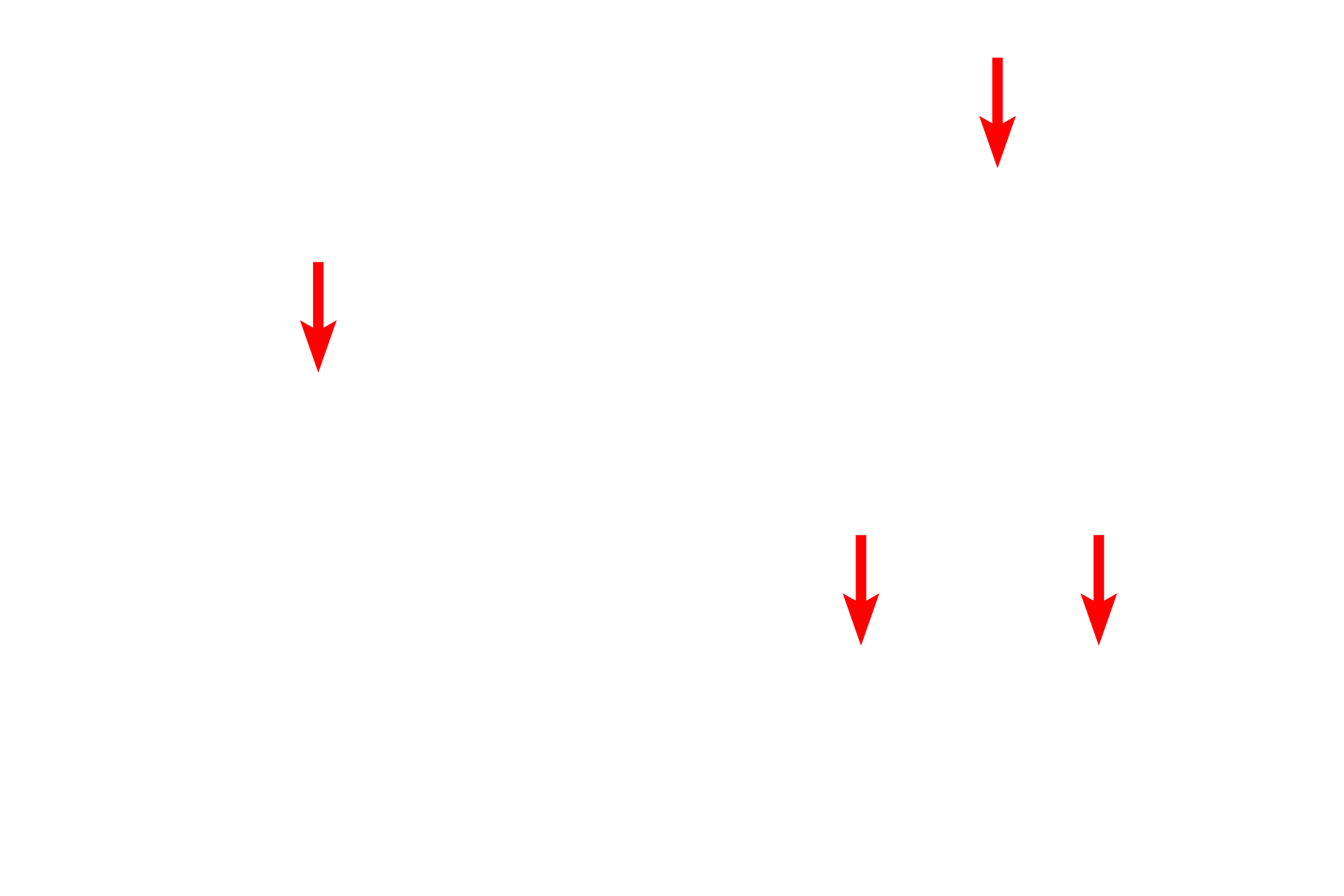 Nuclei <p>Neutrophilic myelocytes are the first definitive cell type in the neutrophilic lineage. At this stage, the cells begin to synthesize neutrophil-specific granules, which then come to predominate since azurophilic granules are no longer being produced. The spherical nucleus of neutrophilic myelocytes develops a distinct indentation at which point they become metamyelocytes. 1000x all</p>
