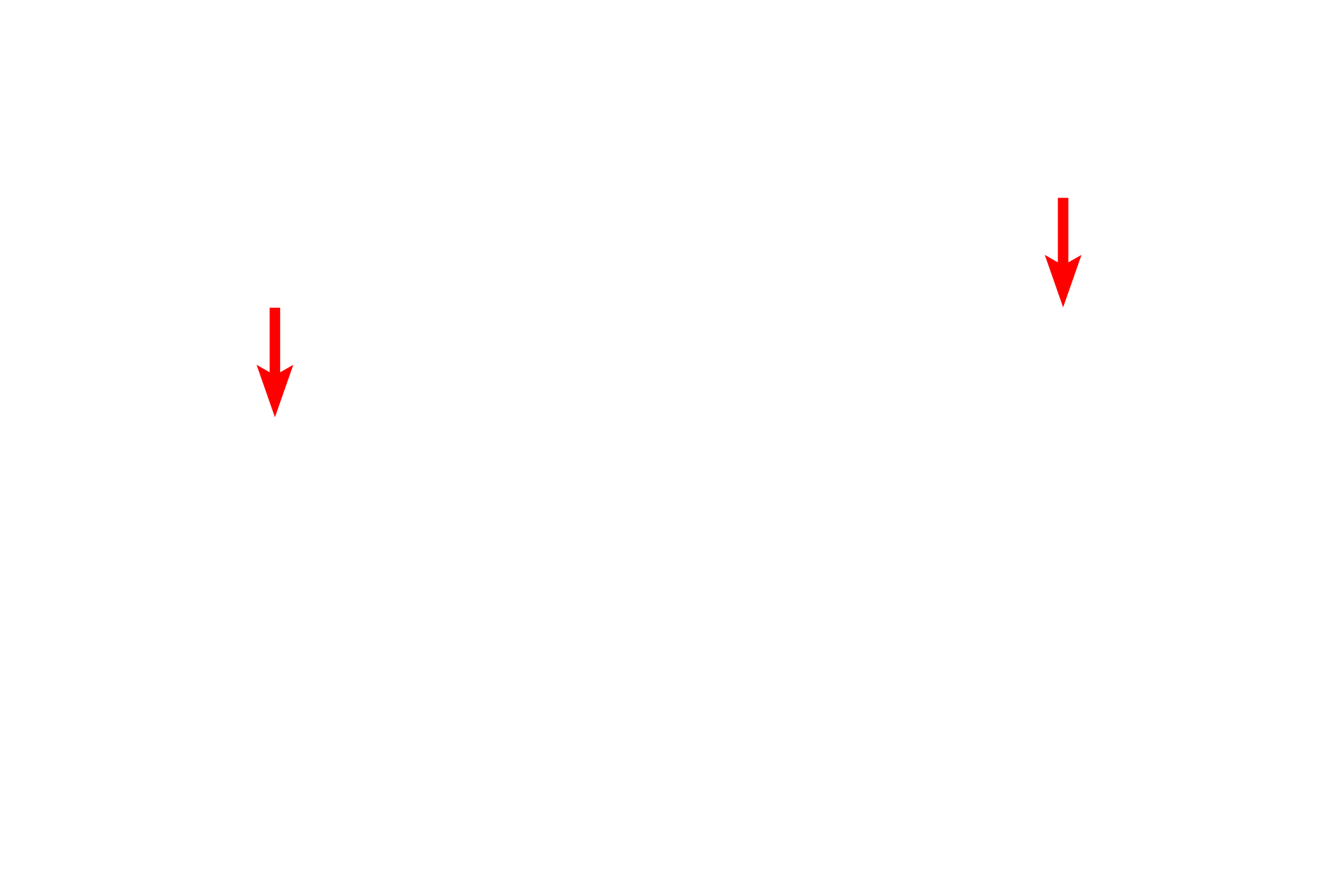 - Nuclei <p>Eosinophilic myelocytes are the first definitive cell type in the eosinophilic lineage. At this stage, the cells begin to synthesize eosinophil-specific granules, which then come to predominate since azurophilic granules are no longer being produced. The nucleus of an eosinophilic myelocyte will develop a distinct indentation, at which point they become metamyelocytes. 1000x, 1000x</p>
