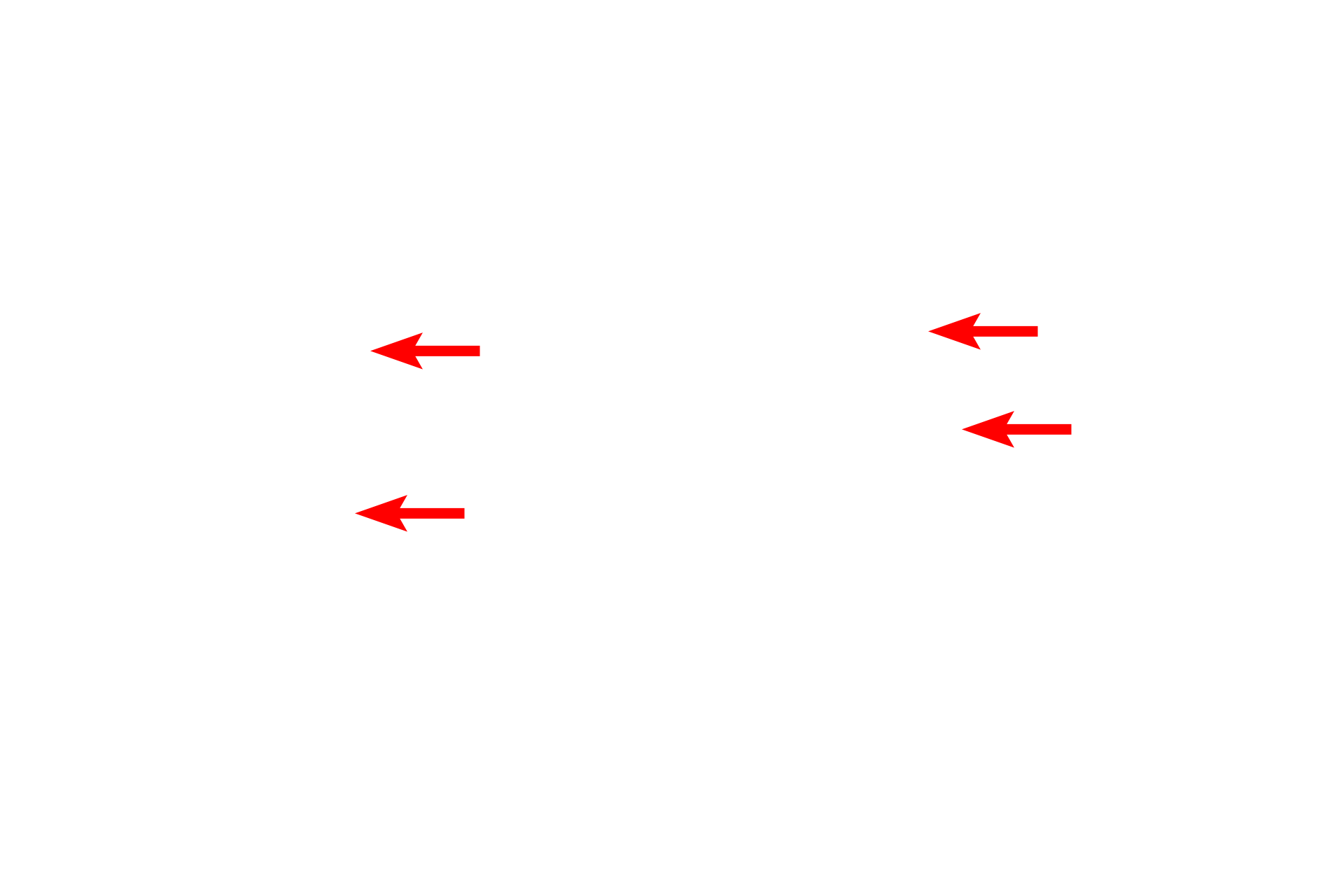  - Granules > <p>Specific or secondary granules in eosinophils contain a variety of proteins including eosinophil major basic protein, RNAases and peroxidase; enzymes important for combating multicellular parasites and certain infections. Due to the cationic nature of these contents, the granules stain intensely with eosin.</p>
