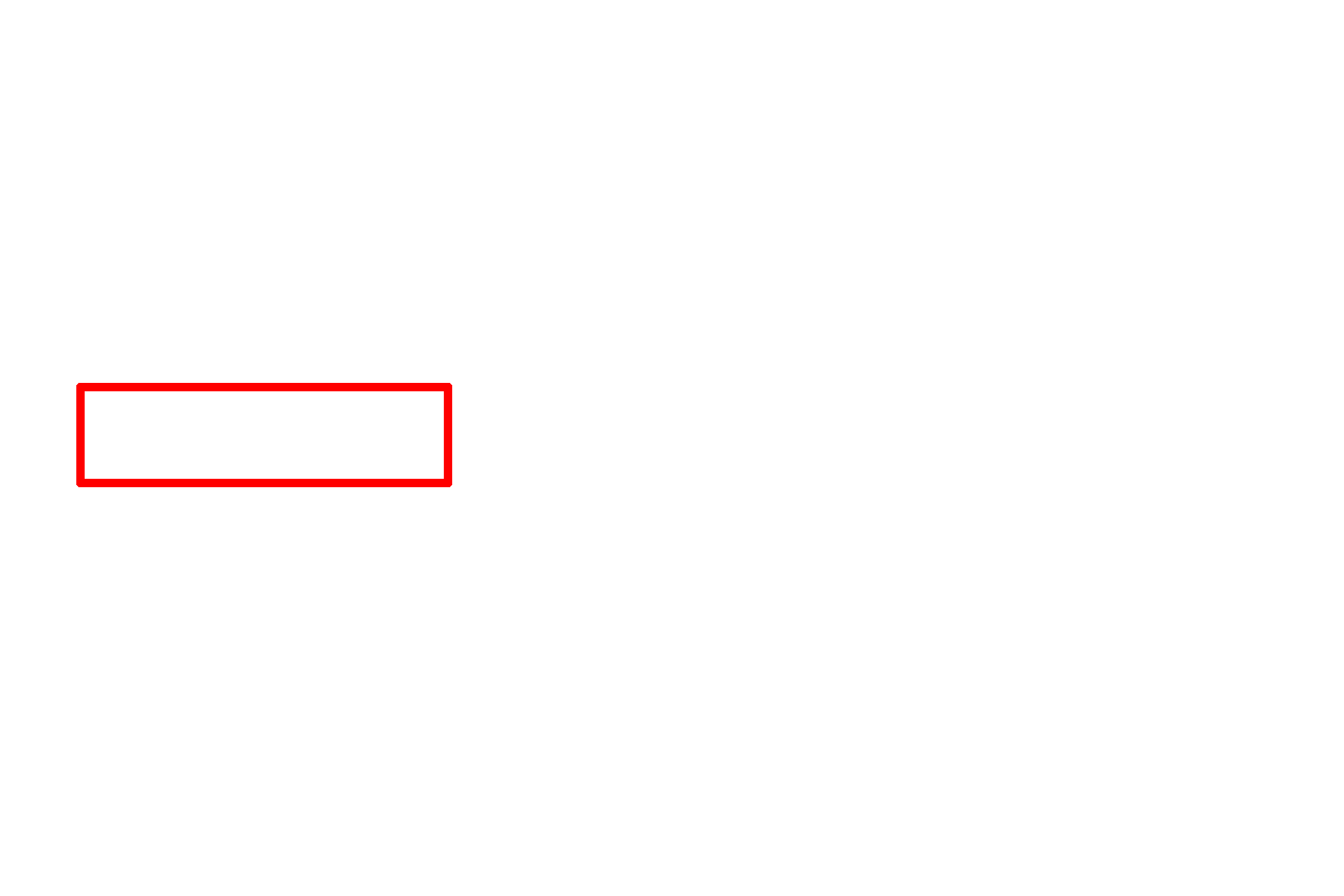Polychromatophilic erythroblast > <p>The polychromatophilic erythroblast is smaller than the basophilic erythroblast and possesses a grayish-stained cytoplasm, due to the recent synthesis of hemoglobin. A “checker-board” chromatin pattern is still apparent.</p>
