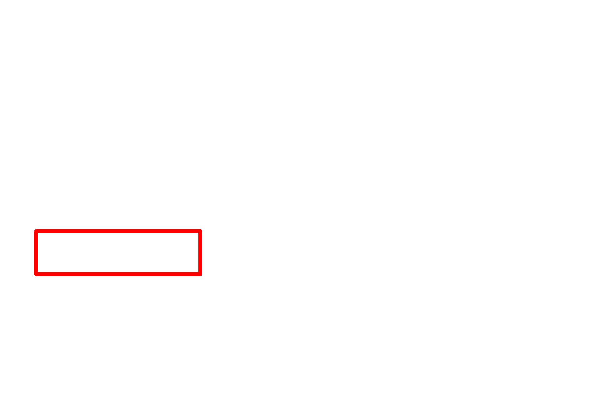 Orthochromatophilic erythroblast > <p>The orthochromatophilic erythroblast represents the smallest stage. This cell possesses eosinophilic cytoplasm due to the loss of ribosomal RNA and the additional accumulation of hemoglobin. The nucleus is small, round and very heterochromatic.</p>
