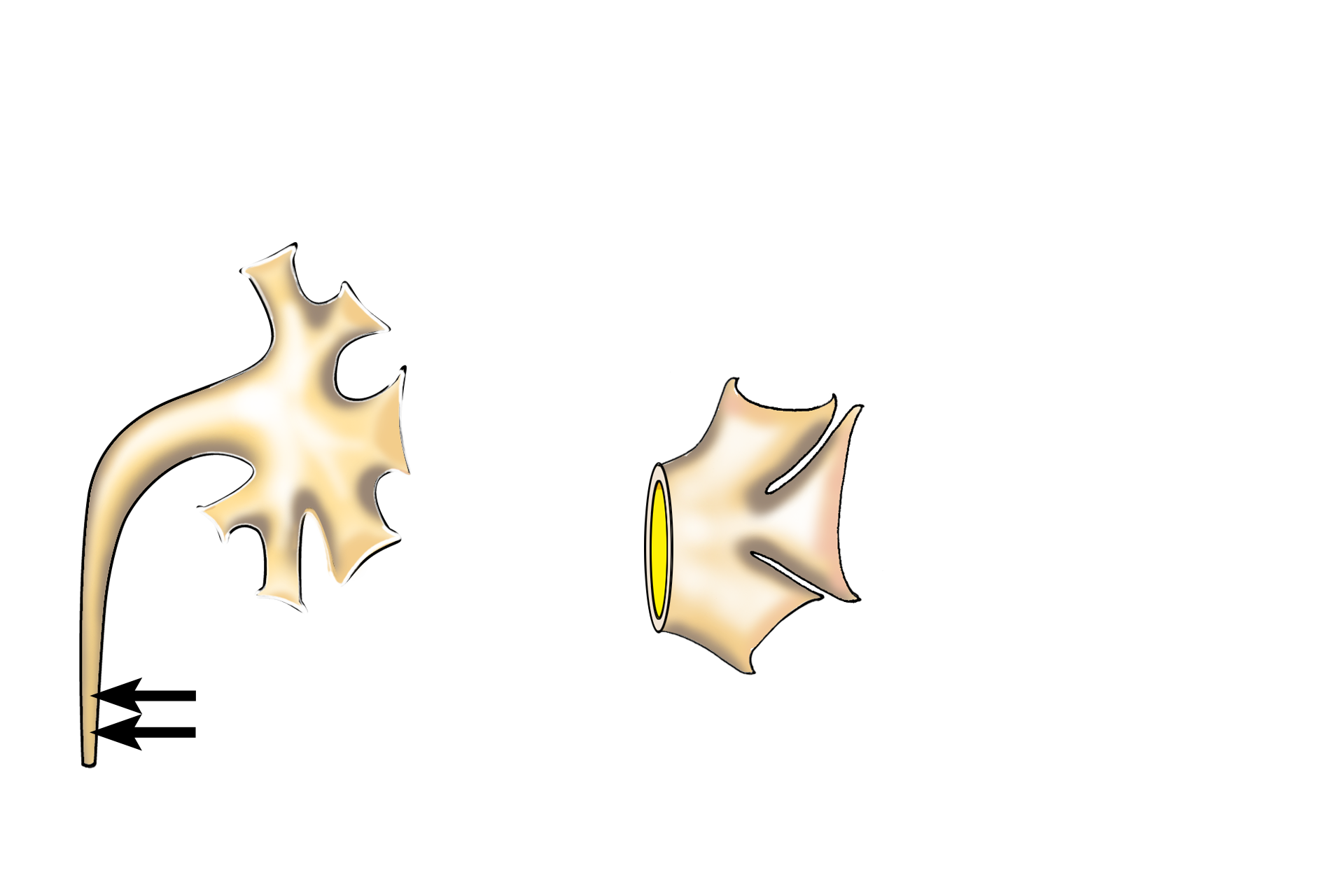  - Ureter <p>Several excretory passages are illustrated.  Minor calyces surround the apices (papillae) of medullary pyramids.  Major calyces are formed by the union of several minor calyces.  Two to three major calyces unite to form the enlarged renal pelvis which continues as the ureter.</p>
