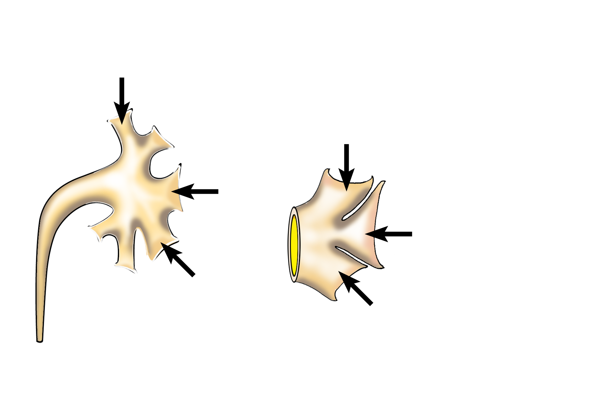  - Minor calyces <p>Several excretory passages are illustrated.  Minor calyces surround the apices (papillae) of medullary pyramids.  Major calyces are formed by the union of several minor calyces.  Two to three major calyces unite to form the enlarged renal pelvis which continues as the ureter.</p>
