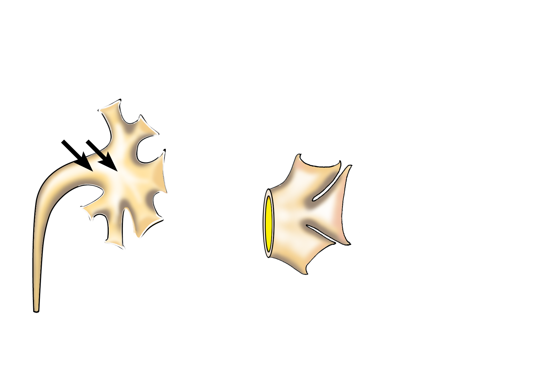  - Renal pelvis <p>Several excretory passages are illustrated.  Minor calyces surround the apices (papillae) of medullary pyramids.  Major calyces are formed by the union of several minor calyces.  Two to three major calyces unite to form the enlarged renal pelvis which continues as the ureter.</p>
