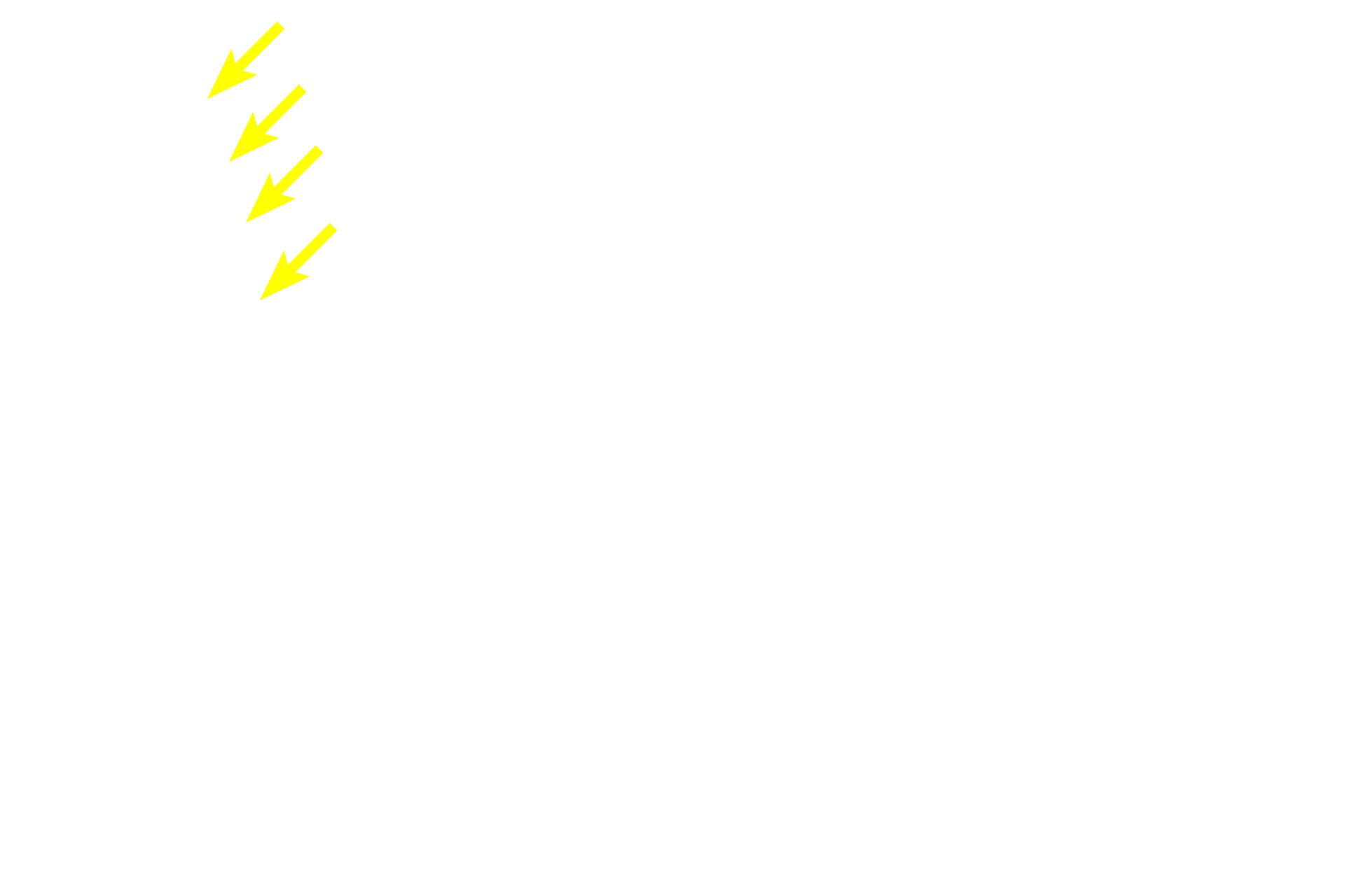  - Medullary ray > <p>Medullary rays contain straight portions of proximal and distal tubules, as well as cortical portions of collecting ducts.  A medulla ray can be identified by the linearity of its tubules and by its lack of renal corpuscles.  Tubules in the medullary rays are directly continuous with similar tubules in the medulla.</p>
