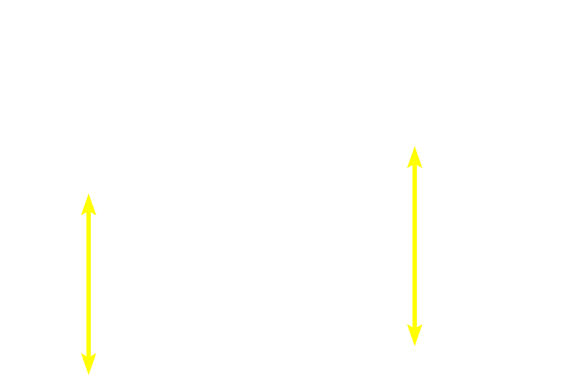Medulla > <p>The medulla is composed of the straight portions of the proximal and distal tubules, the thin limbs of the loops of Henle, and collecting tubules, including the ducts of Bellini.  The medulla can be identified by the linearity of the tubules traversing it and by its lack of renal corpuscles.</p>
