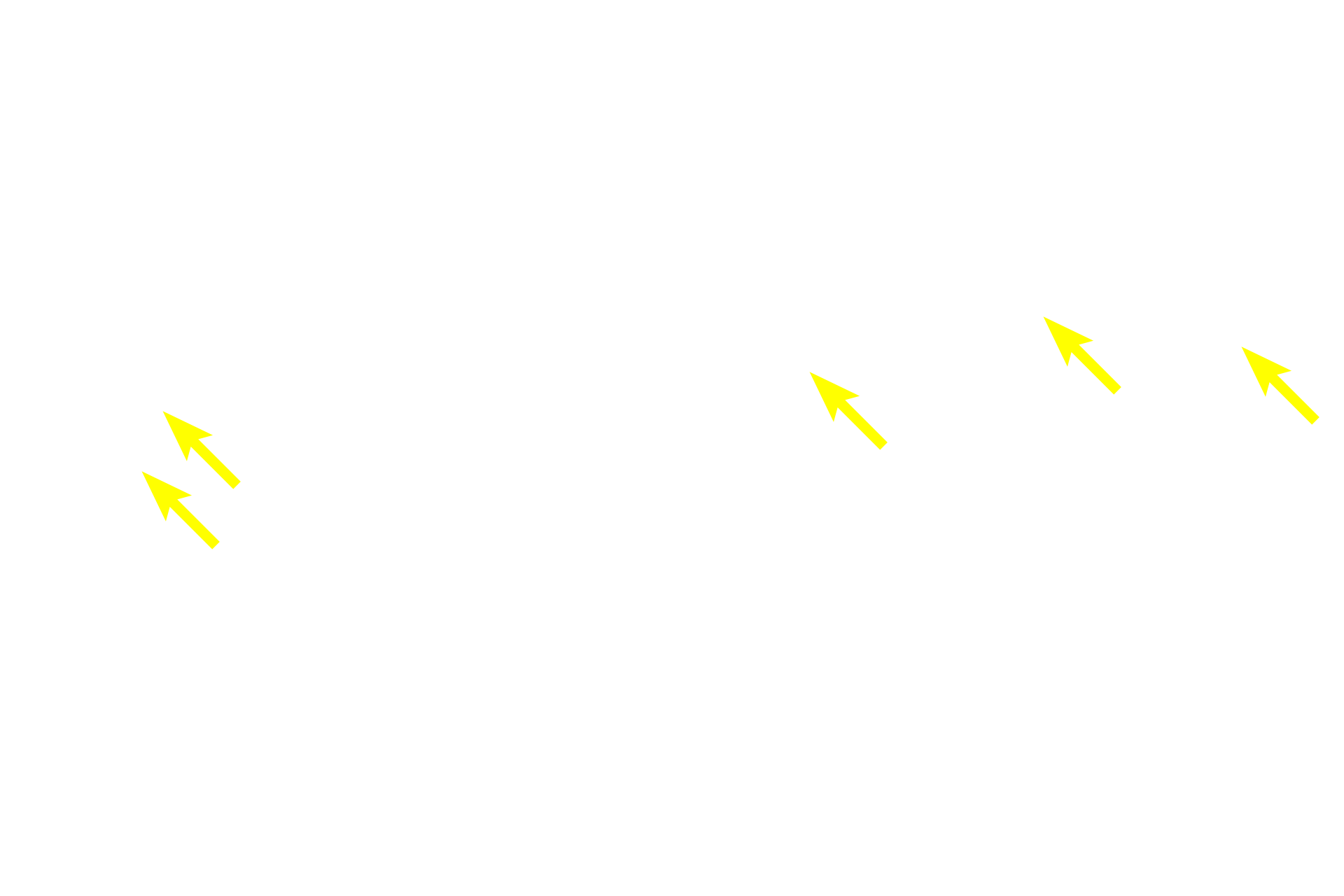 Arcuate vessels > <p>Arcuate blood vessels separate the cortex from the medulla.</p>
