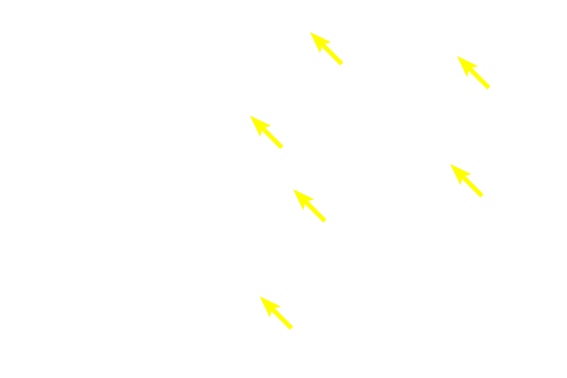  - Renal tubules > <p>The convoluted portions of the proximal and distal regions of the nephron, as well as the initial segment of the collecting duct (the connecting tubule), are present in the regions between the renal corpuscles.</p>
