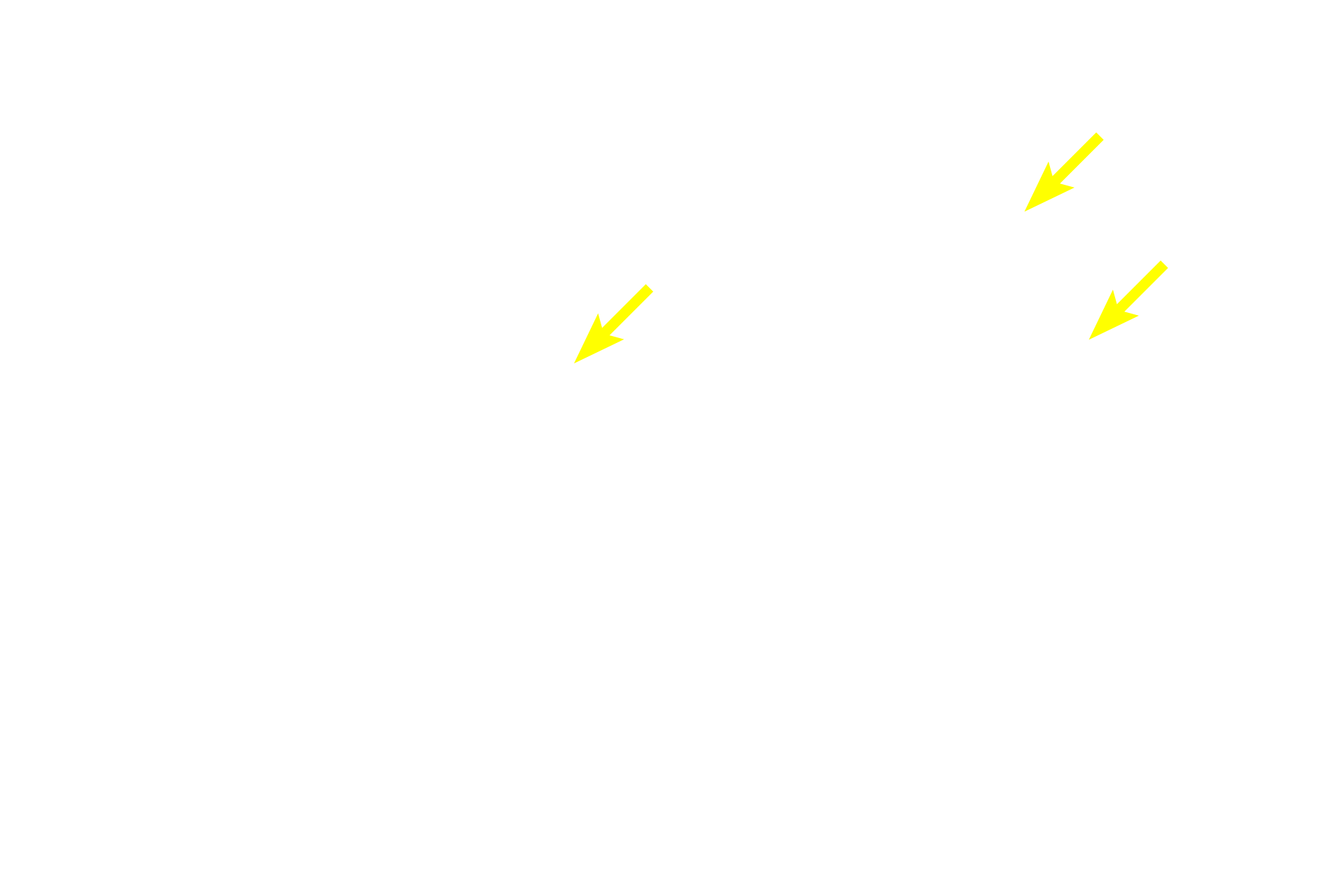 Afferent arterioles > <p>Afferent arterioles branch from the interlobular arteries to supply the capillary tuft called the glomerulus.</p>
