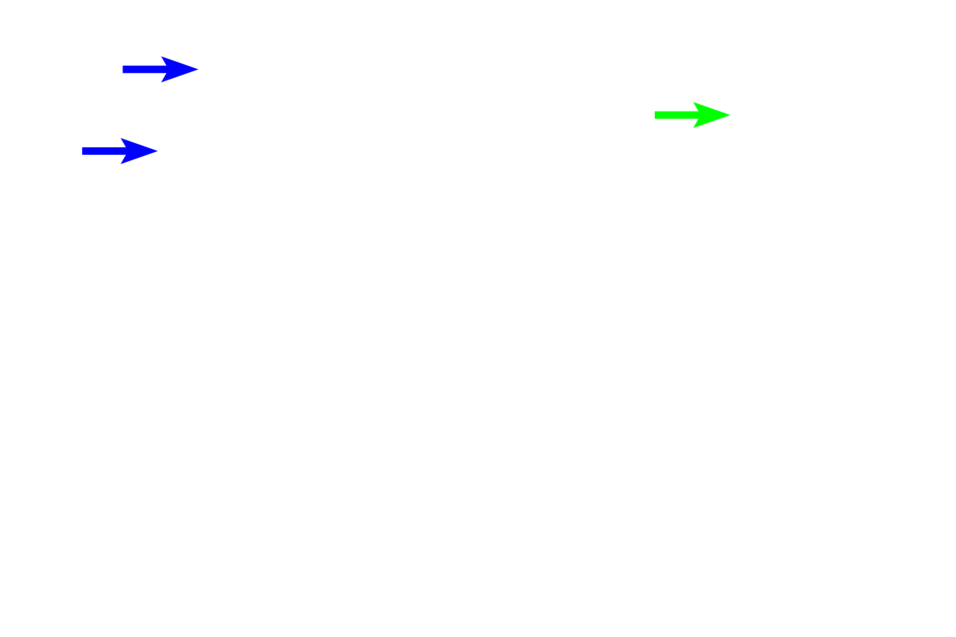 Proximal convoluted tubule > <p>The proximal convoluted tubule is continuous with and drains the filtrate from Bowman’s capsule.  This segment of the nephron is located in the convoluted portion of the renal cortex.</p>
