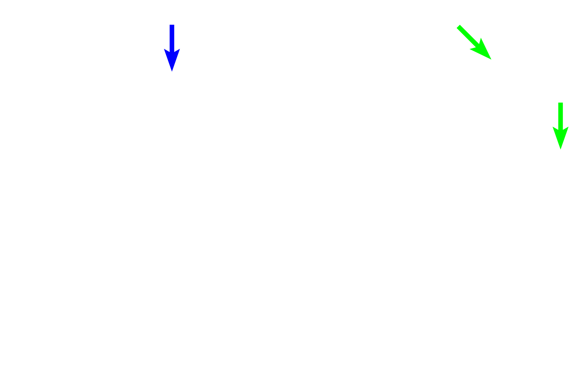 Bowman's space <p>Components of the nephron in the convoluted portions of the cortex include Bowman’s capsule (surrounding the glomerulus), proximal convoluted tubule and distal convoluted tubule.  The portions of the nephron in the medullary ray are the proximal straight tubule (descending thick limb of the loop of Henle) and the distal straight tubule (ascending thick limb of the loop of Henle).  200x</p>
