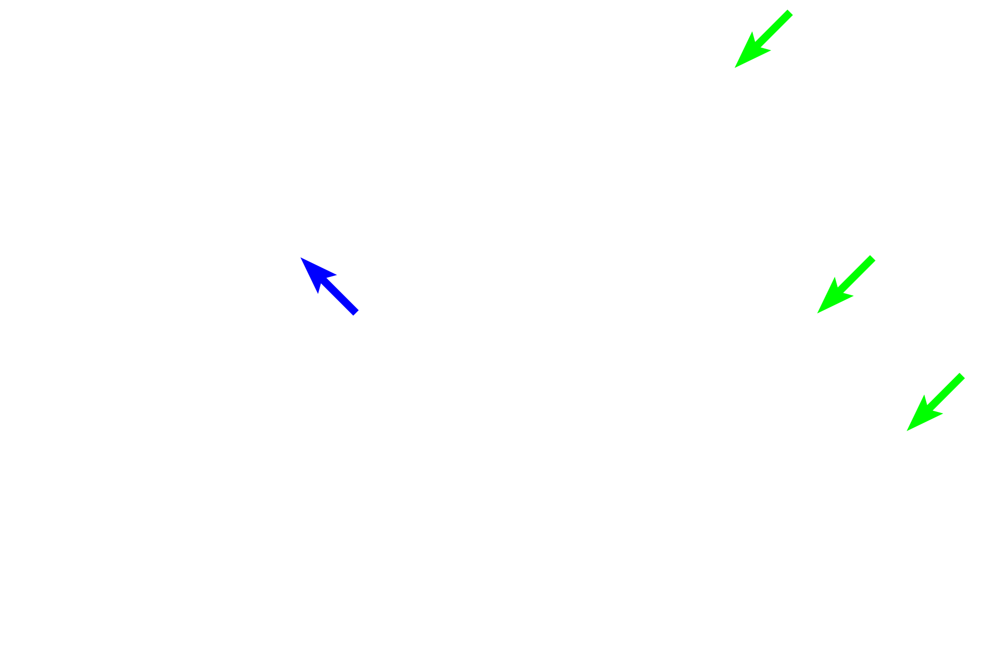 Connecting tubule <p>Components of the nephron in the convoluted portions of the cortex include Bowman’s capsule (surrounding the glomerulus), proximal convoluted tubule and distal convoluted tubule.  The portions of the nephron in the medullary ray are the proximal straight tubule (descending thick limb of the loop of Henle) and the distal straight tubule (ascending thick limb of the loop of Henle).  200x</p>
