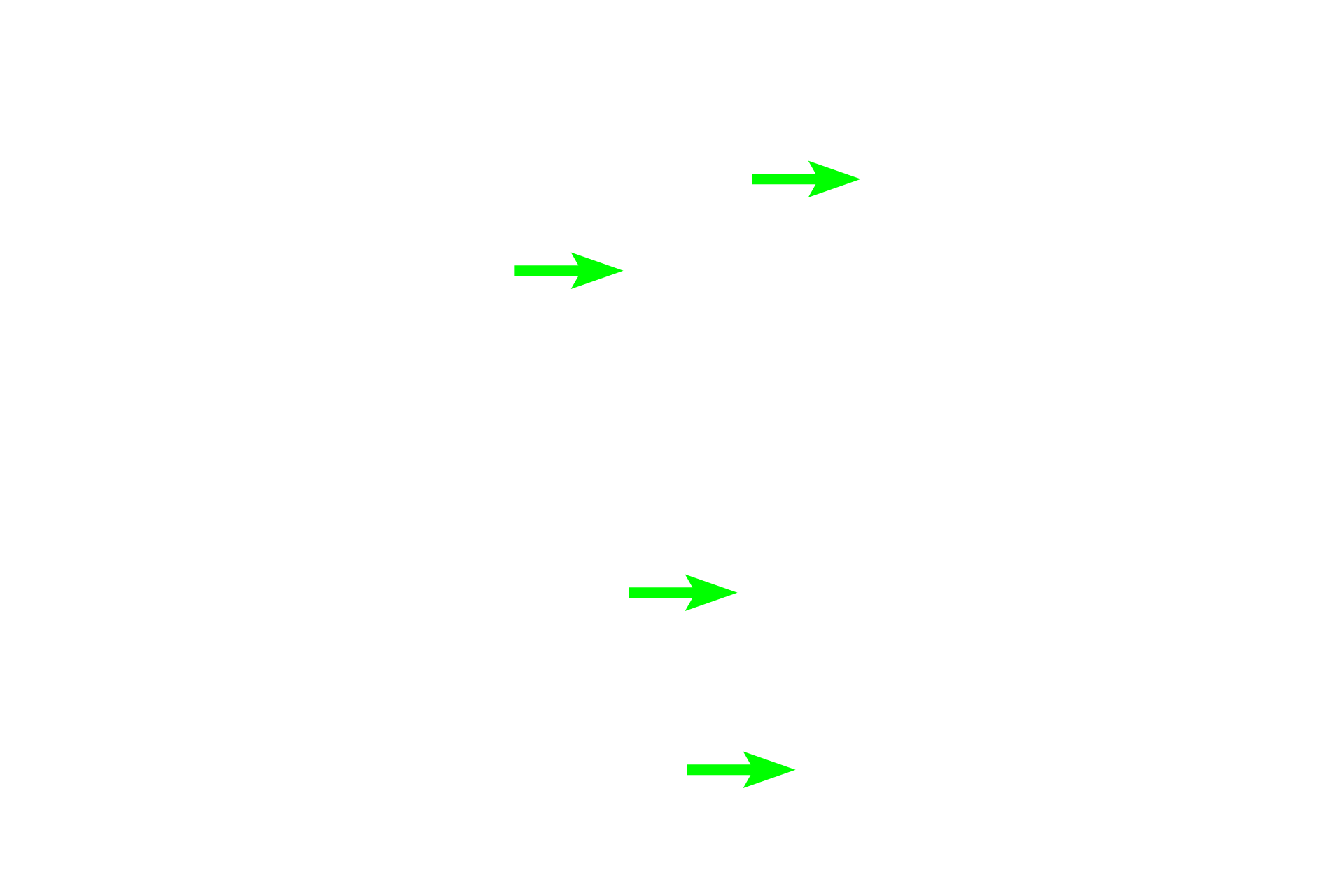 Thin limbs <p>The medulla contains the straight portions of the proximal and distal tubules, the thin limbs of the loops of Henle, and collecting ducts.  Because of their linear course through the medullary pyramid, these tubules are usually seen in longitudinal section, lying parallel to one another.  200x, 20x</p>

