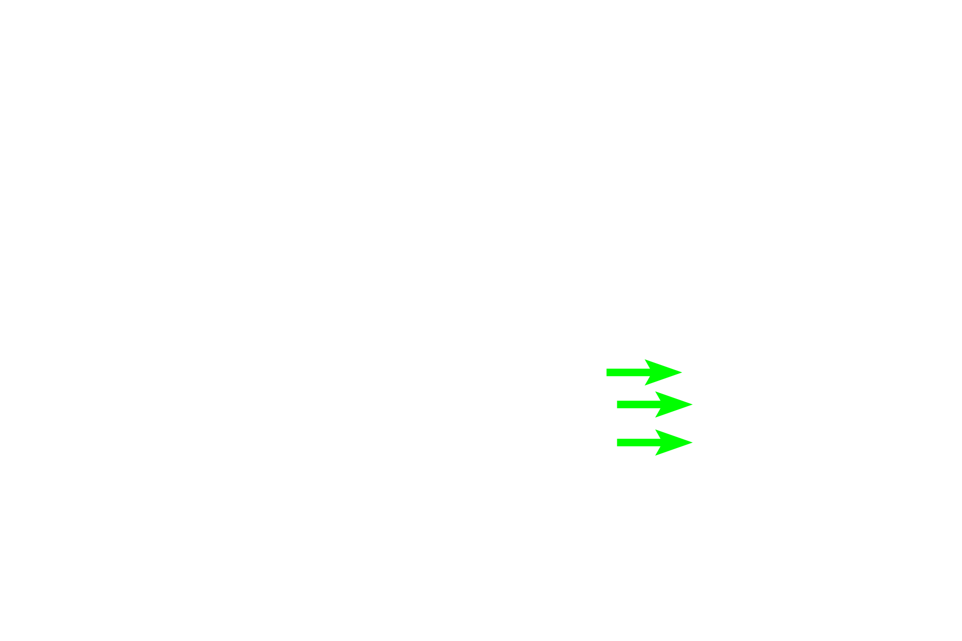 Juxtaglomerular cells <p>The ascending thick limb associated with this renal corpuscle loops back to its own vascular pole, where it lies adjacent to the afferent arteriole. Modified cells in the wall of the tubule, the macula densa, and cells in the wall of the afferent arteriole, juxtaglomerular cells, comprise the juxtaglomerular apparatus, which regulates blood pressure and blood volume.</p>
