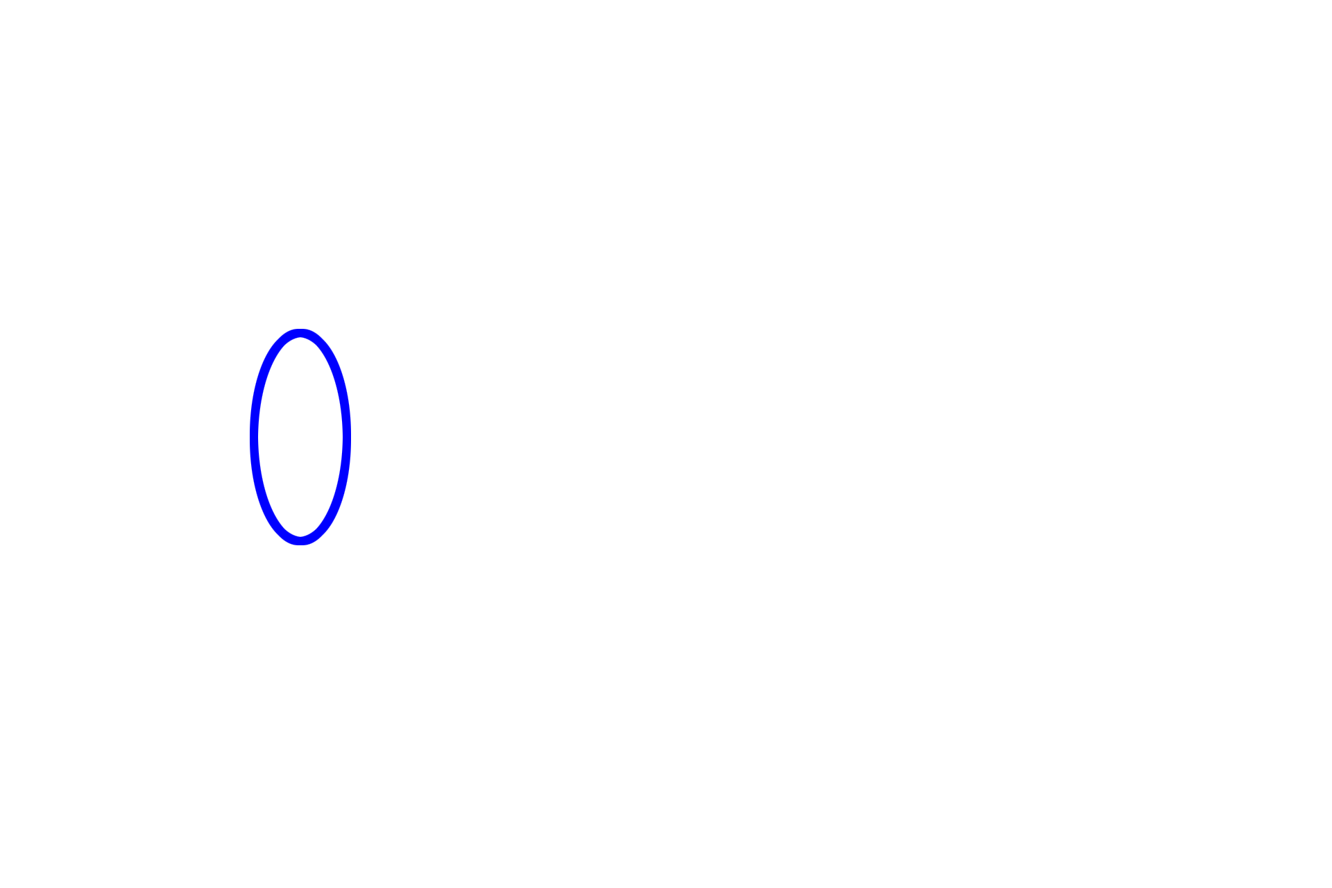 Urinary pole > <p>The urinary pole is the continuation of the simple squamous epithelium of the parietal layer of Bowman’s capsule with the epithelium forming the proximal convoluted tubule.  At the urinary pole, the filtrate accumulating in Bowman’s space enters the first tubular part of the nephron, the proximal convoluted tubule.</p>
