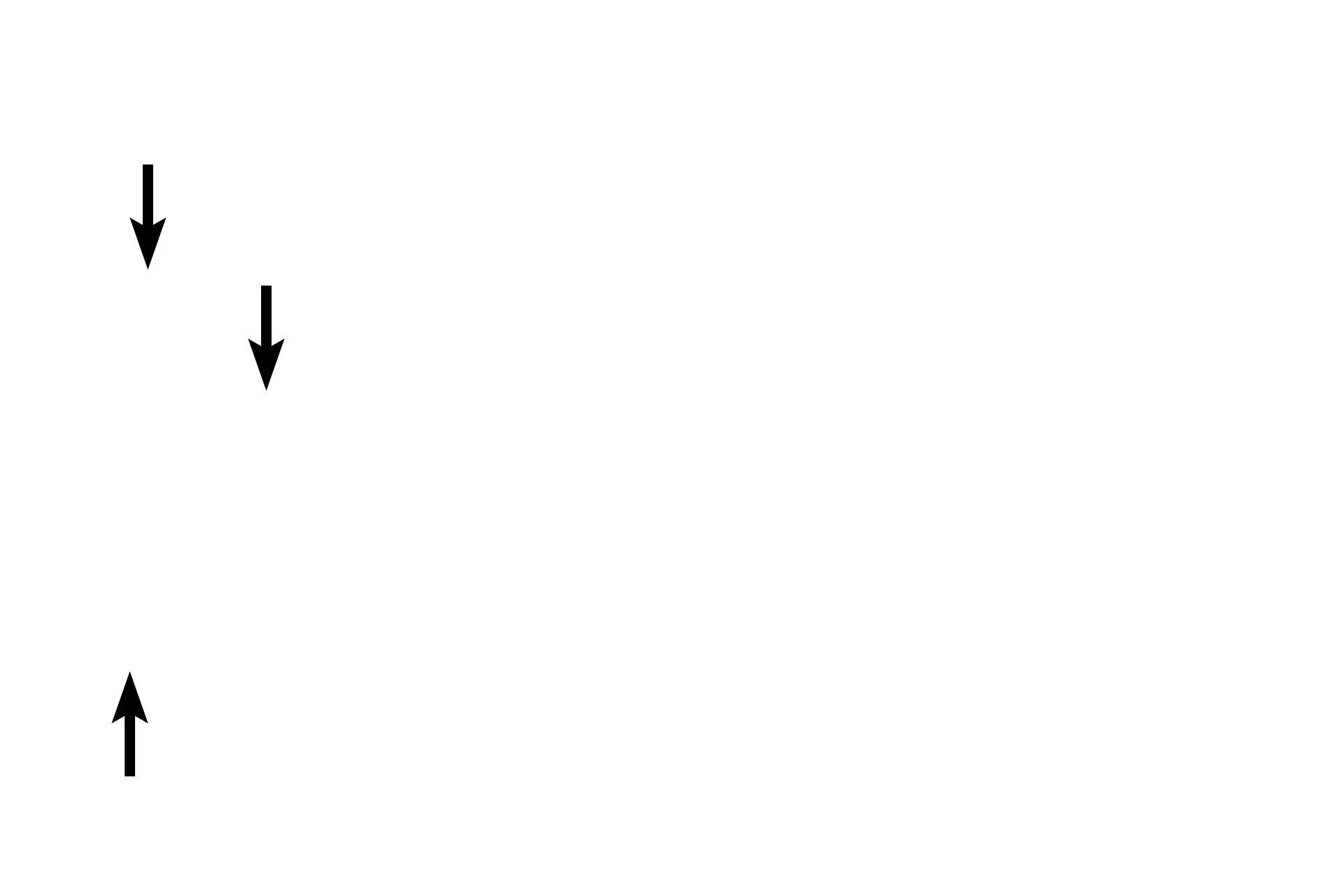 Proximal convoluted tubule <p>The urinary pole is the continuation of the simple squamous epithelium of the parietal layer of Bowman’s capsule with the epithelium forming the proximal convoluted tubule.  At the urinary pole, the filtrate accumulating in Bowman’s space enters the first tubular part of the nephron, the proximal convoluted tubule.</p>
