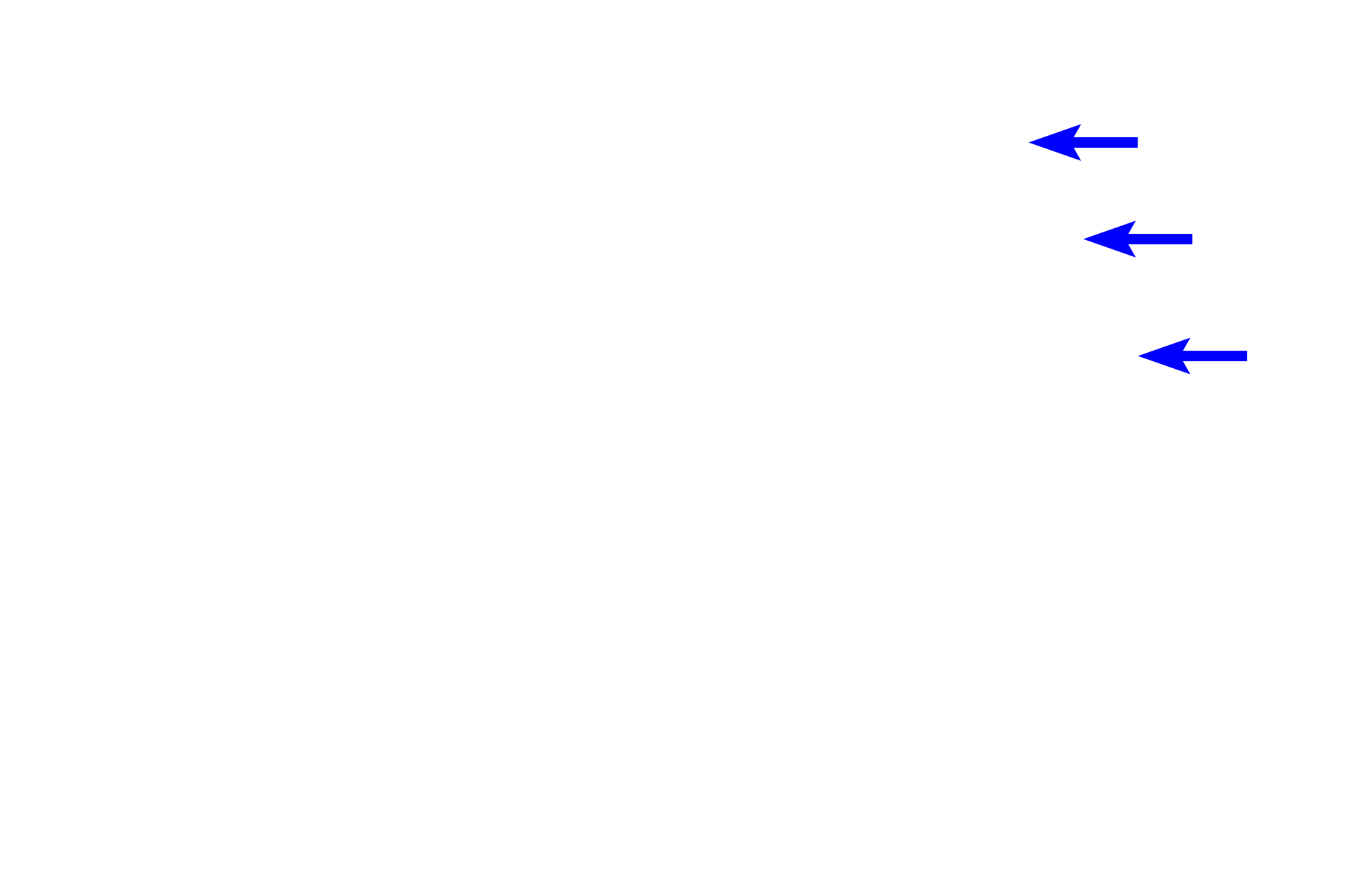 Ascending thick limb > <p>The ascending thick limb associated with this renal corpuscle loops back to its own vascular pole, where it lies adjacent to the afferent arteriole. Modified cells in the wall of the tubule, the macula densa, and cells in the wall of the afferent arteriole, juxtaglomerular cells, comprise the juxtaglomerular apparatus, which regulates blood pressure and blood volume.</p>
