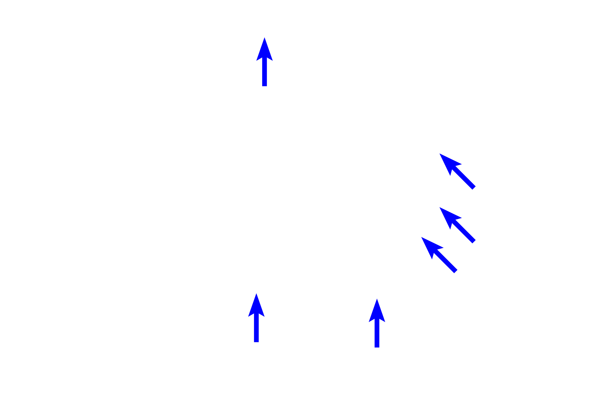 Bowman's capsule > <p>Bowman’s capsule is a double walled structure enclosing the glomerulus.  An inner layer of cells, podocytes (visceral layer), surrounds the glomerular capillaries and serves as part of the filtration barrier.  The outer parietal layer is a simple squamous epithelium, continuous with the proximal convoluted tubule.  Separating the layers is Bowman’s space, where the filtrate accumulates.</p>
