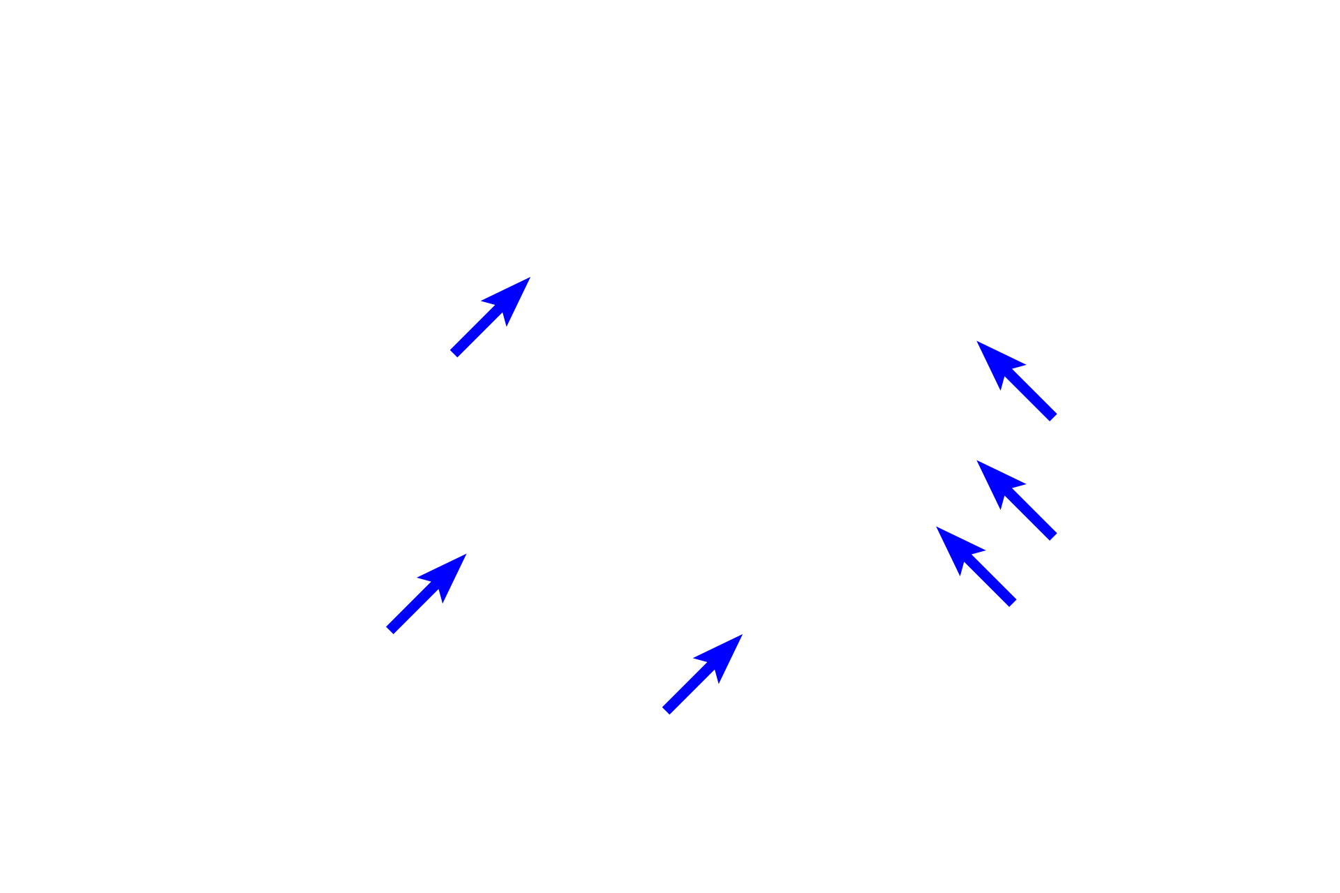  - Visceral layer <p>Bowman’s capsule is a double walled structure enclosing the glomerulus.  An inner layer of cells, podocytes (visceral layer), surrounds the glomerular capillaries and serves as part of the filtration barrier.  The outer parietal layer is a simple squamous epithelium, continuous with the proximal convoluted tubule.  Separating the layers is Bowman’s space, where the filtrate accumulates.</p>
