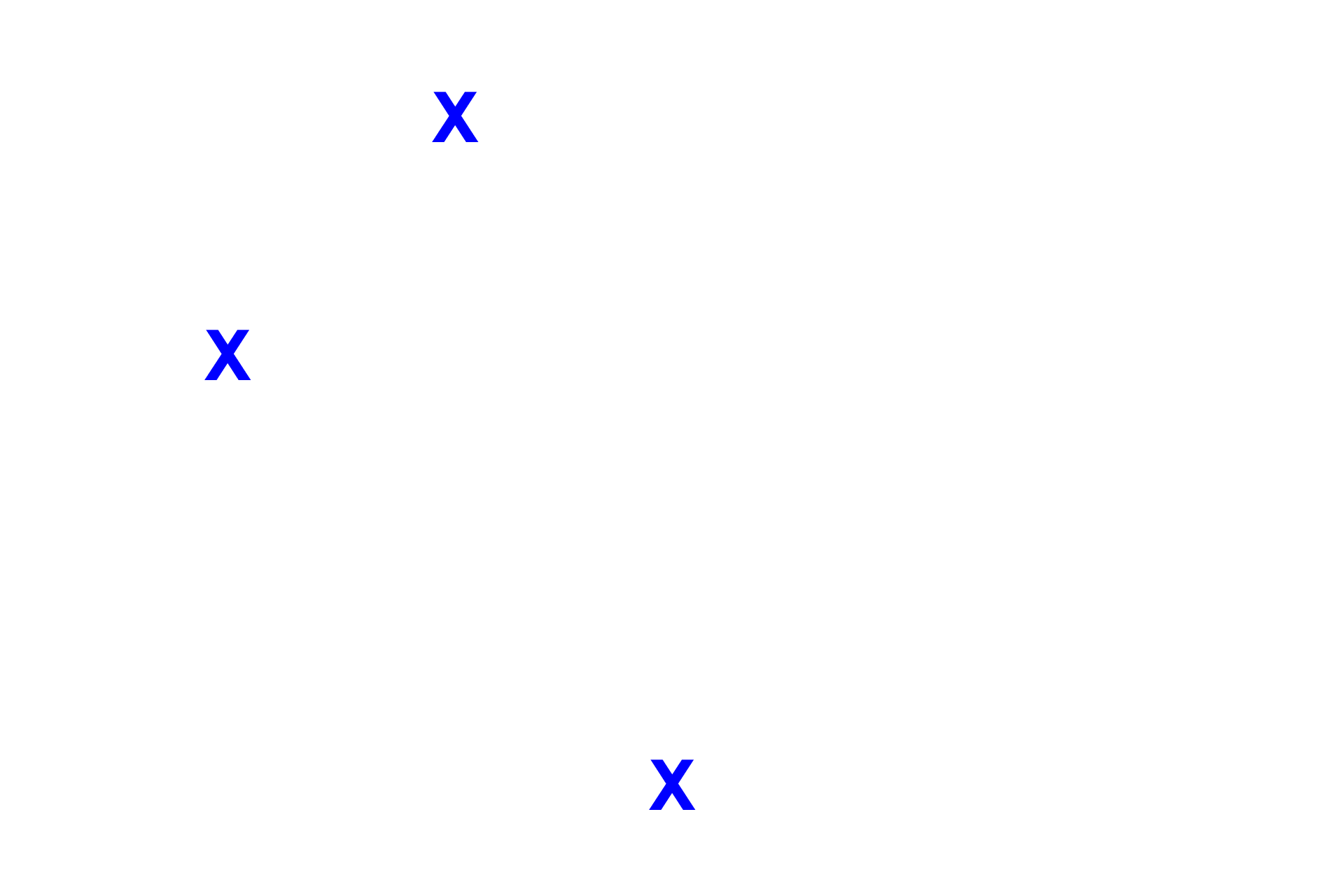  - Bowman's space <p>The glomerular tuft of capillaries is surrounded by the visceral layer of Bowman’s capsule, whose modified cells form podocytes.  The parietal layer of Bowman’s capsule is composed of simple squamous epithelium.  10x, 400x</p>
