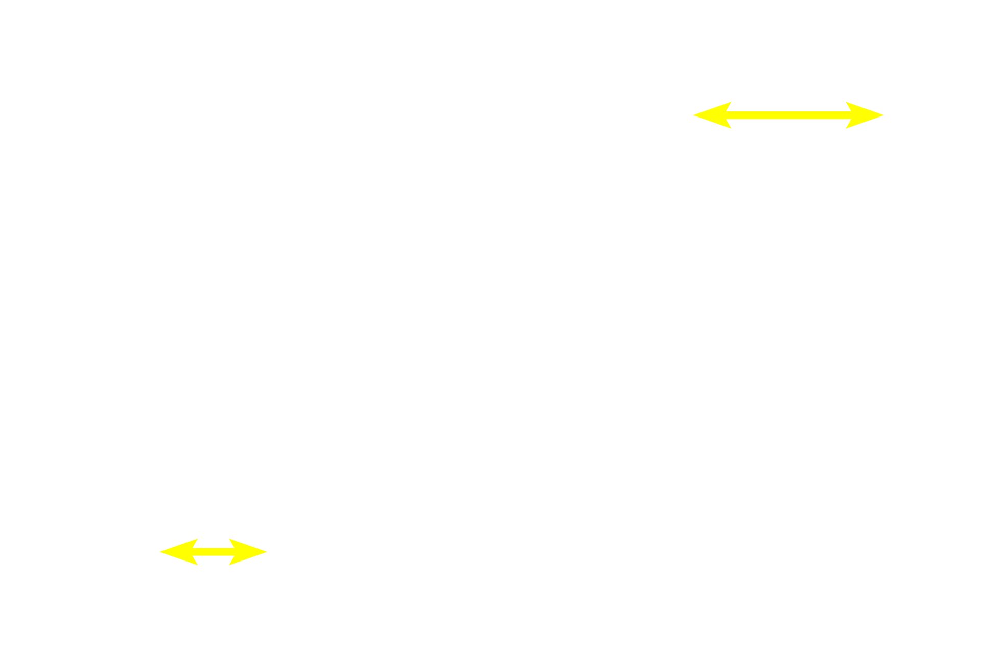 Proximal convoluted tubules <p>The glomerular tuft of capillaries is surrounded by the visceral layer of Bowman’s capsule, whose modified cells form podocytes.  The parietal layer of Bowman’s capsule is composed of simple squamous epithelium.  10x, 400x</p>
