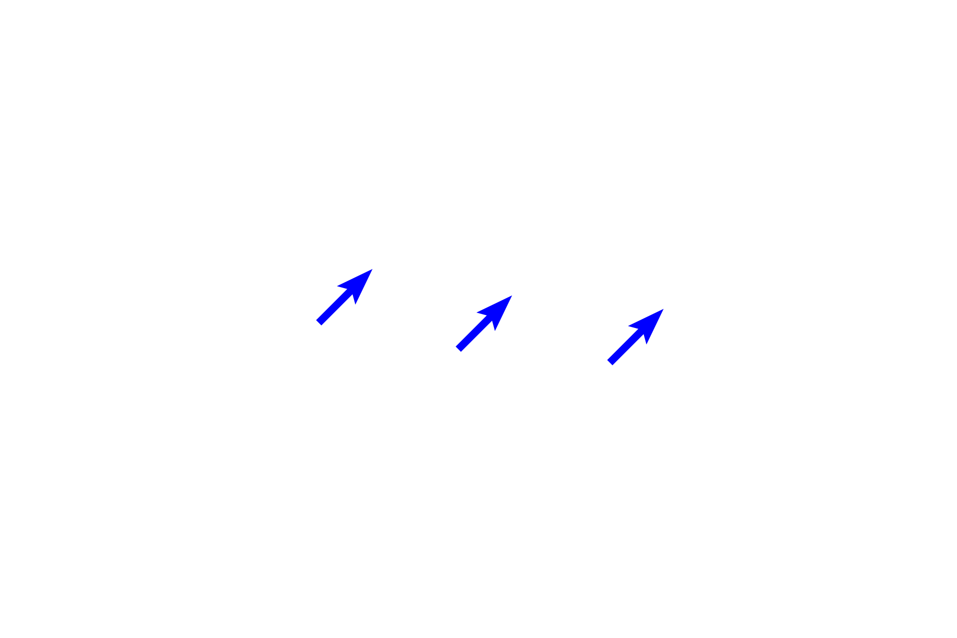 Podocytes > <p>The visceral layer of Bowman’s capsule is composed of specialized cells called podocytes, which possess numerous foot processes that wrap around the glomerular capillaries. These cells, along with the fenestrated endothelium of the glomerular capillaries and their fused basal laminae, form the glomerular filtration barrier.</p>
