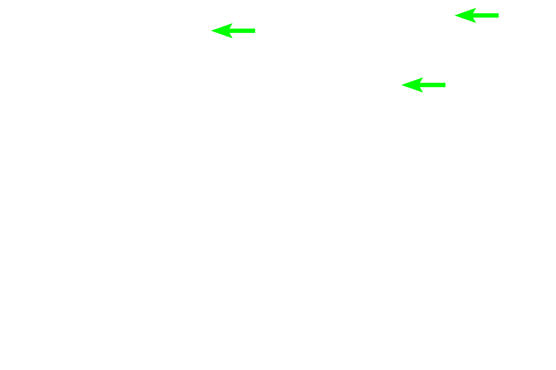 Mesangial cells > <p>Mesangial cells are wedged between the endothelial cells and the podocytes.  They add support to the walls of the capillaries and are also phagocytic.</p>
