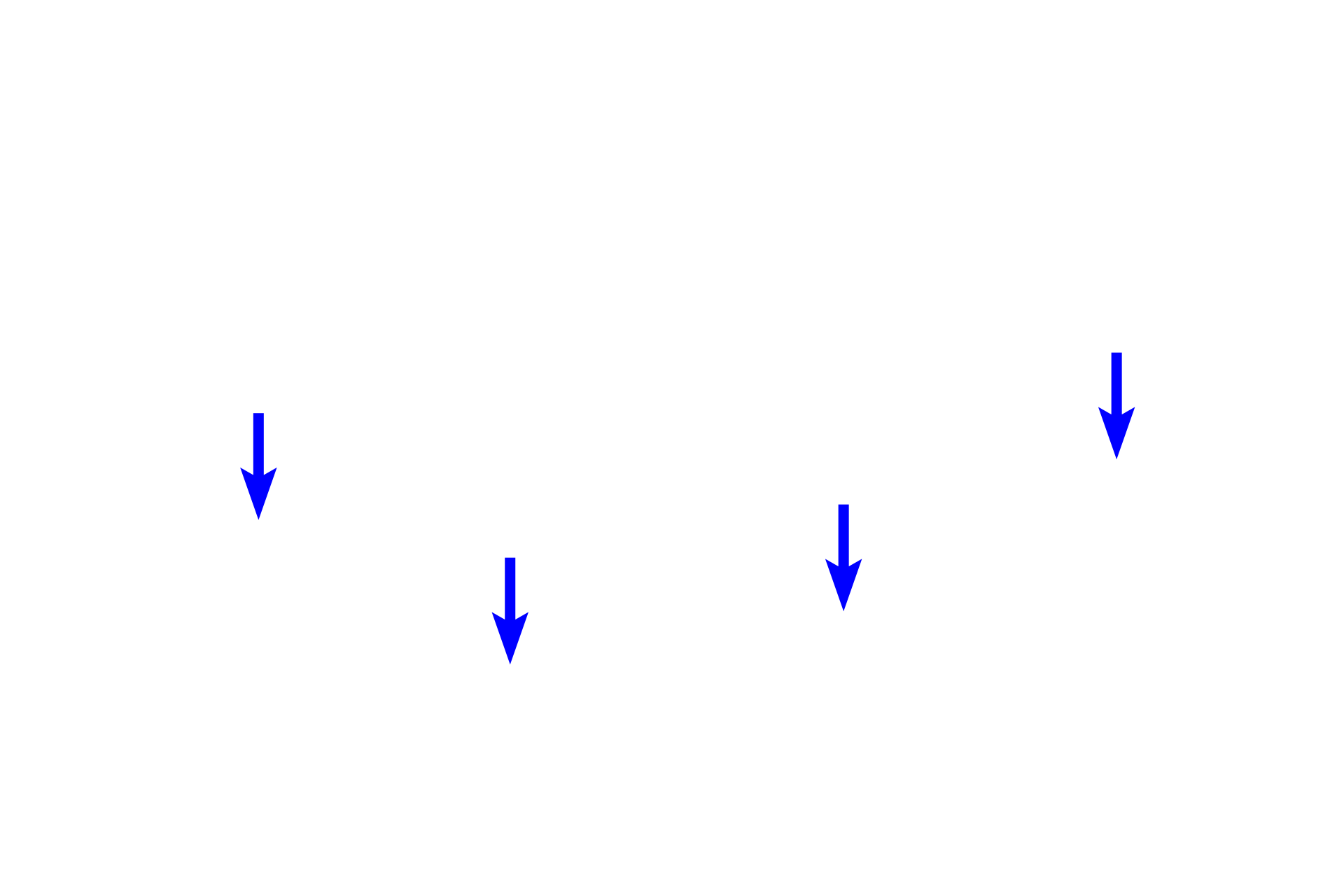 Parietal layer of Bowman's capsule > <p>The parietal layer of Bowman’s capsule lines the perimeter of the capsule and is composed of simple squamous epithelial cells.</p>
