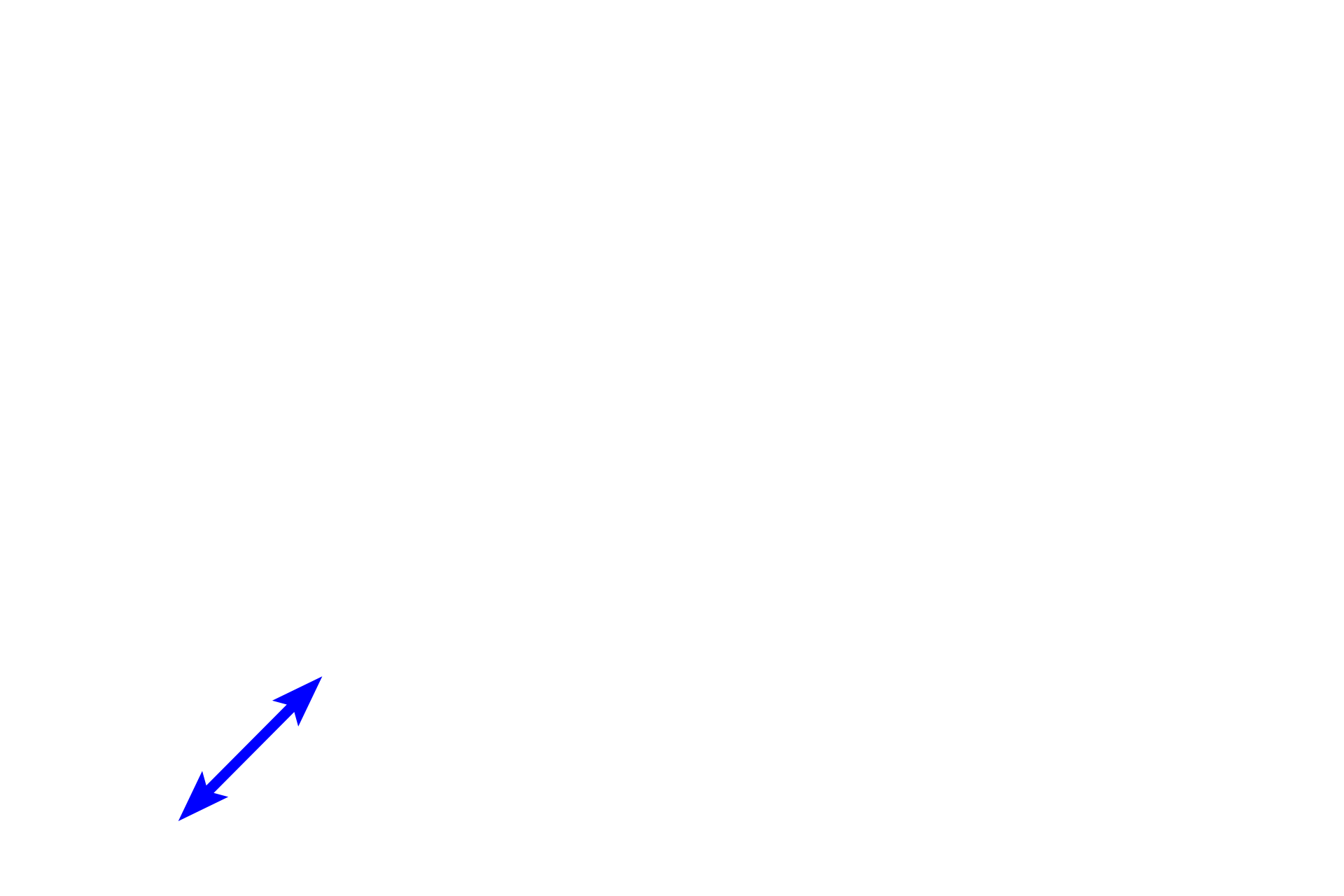 Distal convoluted tubule  <p>The proximal convoluted tubule is lined by a tall cuboidal epithelium with a brush border. The numerous vacuole-appearing structures in the cytoplasm are artifactually-disrupted mitochondria. This distal convoluted tubule shows the characteristic low cuboidal epithelial lining with irregularly spaced nuclei.  </p>
