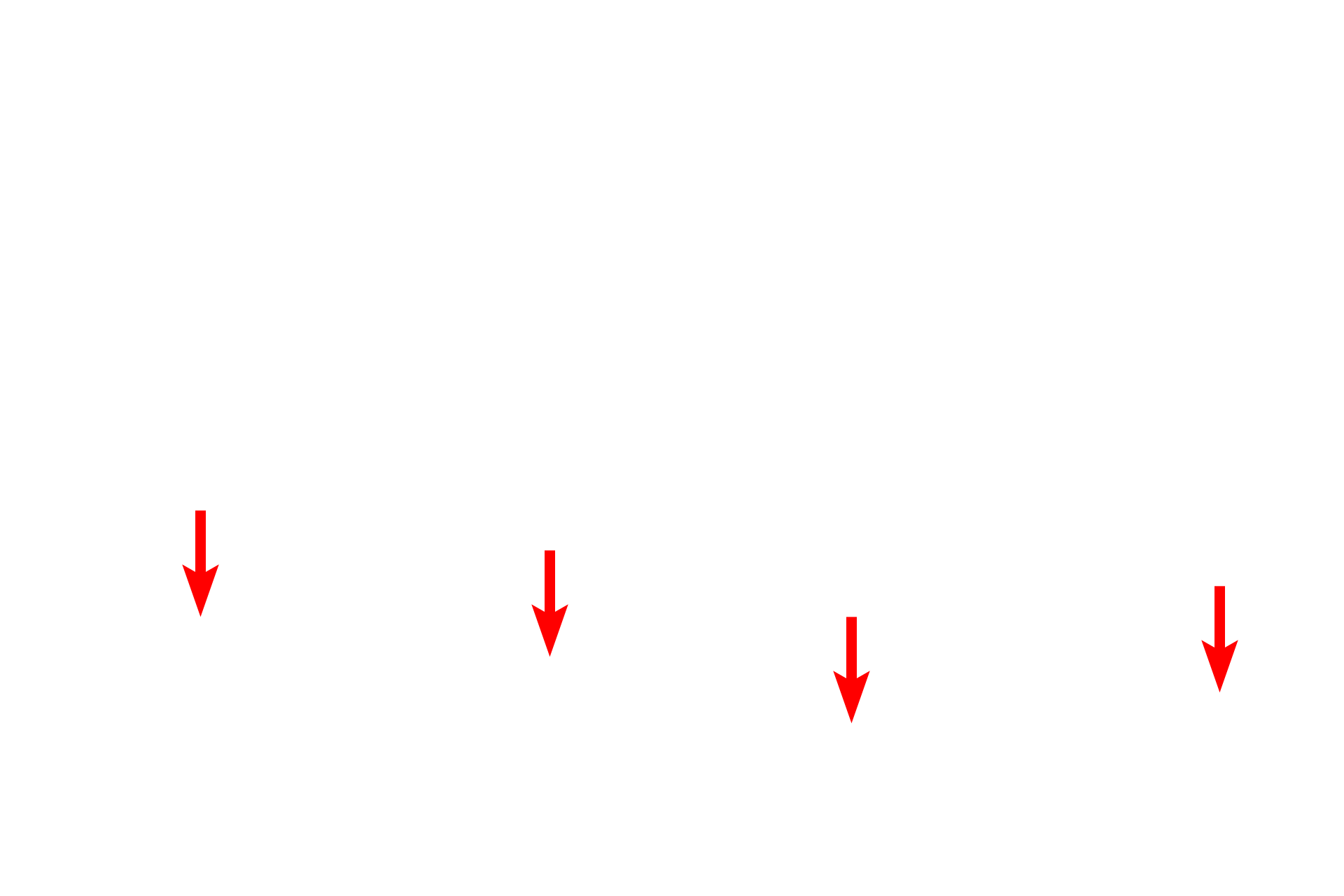 Parietal layer of Bowman's capsule <p>This electron micrograph shows a portion of a glomerulus, separated from the parietal layer of Bowman’s capsule by Bowman’s space.  The parietal layer consists of a simple squamous epithelium, which is continuous with the visceral layer (podocytes) at the vascular pole of the glomerulus.  4000x</p>
