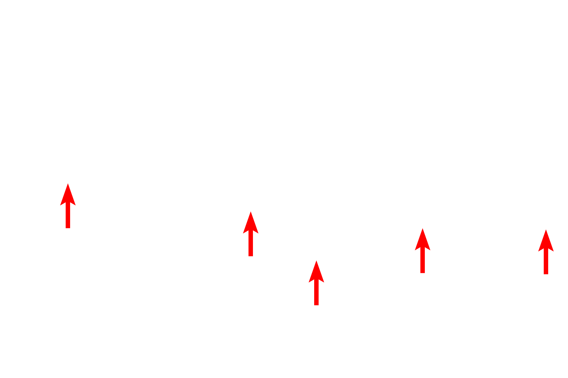  - Visceral layer of Bowman's capsule (Podocytes) <p>This electron micrograph shows a portion of a glomerulus, separated from the parietal layer of Bowman’s capsule by Bowman’s space.  The parietal layer consists of a simple squamous epithelium, which is continuous with the visceral layer (podocytes) at the vascular pole of the glomerulus.  4000x</p>
