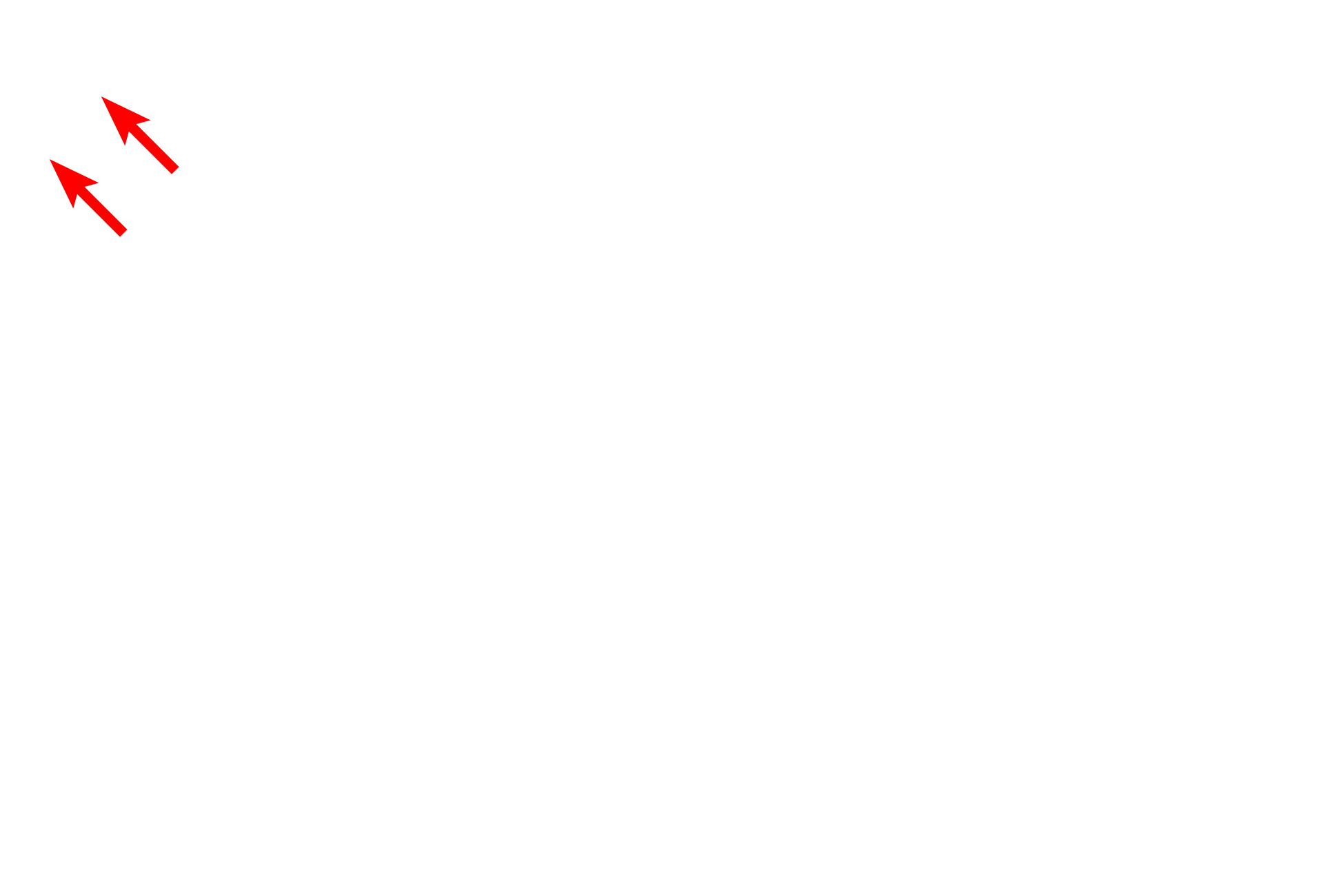  - Mesangial cell <p>This electron micrograph shows a portion of a glomerulus, separated from the parietal layer of Bowman’s capsule by Bowman’s space.  The parietal layer consists of a simple squamous epithelium, which is continuous with the visceral layer (podocytes) at the vascular pole of the glomerulus.  4000x</p>
