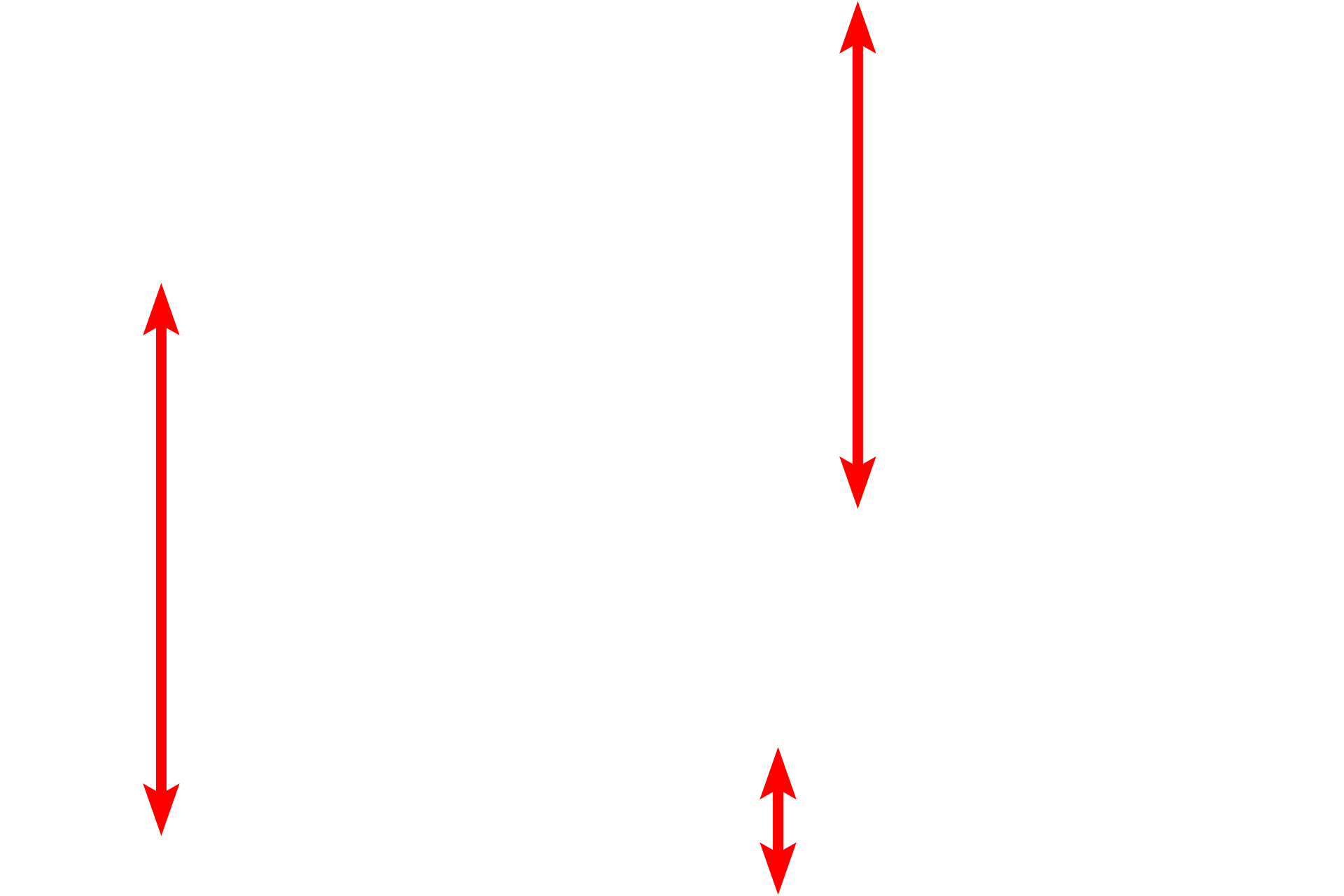 Glomerular capillaries <p>This electron micrograph shows a podocyte, with its processes contacting three glomerular capillaries.  A primary process of the podocyte branches to form secondary processes called pedicels, which rest on the glomerular basal lamina. Pedicels from one podocyte alternate with those from a different podocyte as they contact the capillary.  Also visible is the fenestrated capillary endothelium.  6000x</p>
