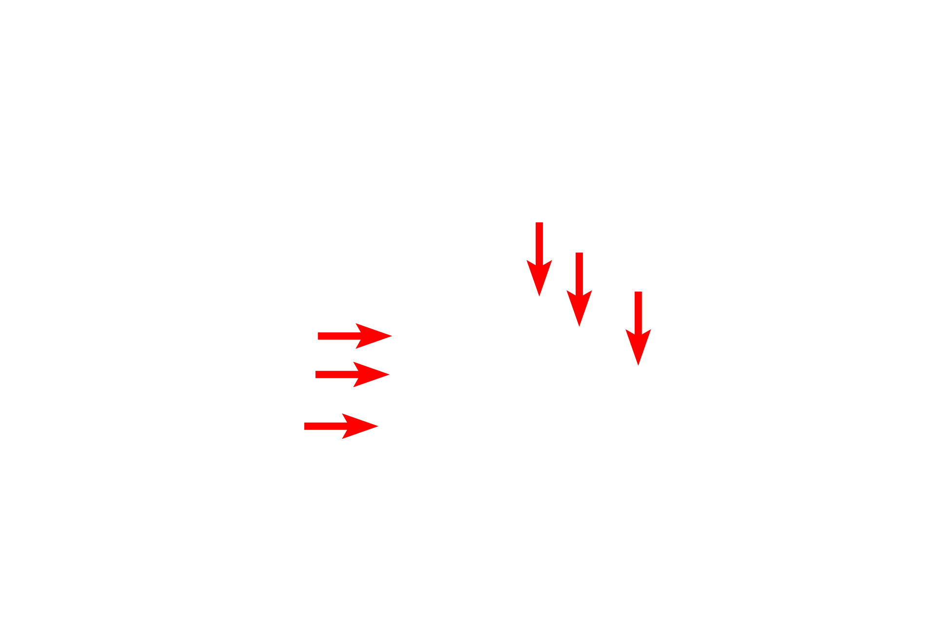  - Fenestrated endothelium <p>This electron micrograph shows a podocyte, with its processes contacting three glomerular capillaries.  A primary process of the podocyte branches to form secondary processes called pedicels, which rest on the glomerular basal lamina. Pedicels from one podocyte alternate with those from a different podocyte as they contact the capillary.  Also visible is the fenestrated capillary endothelium.  6000x</p>
