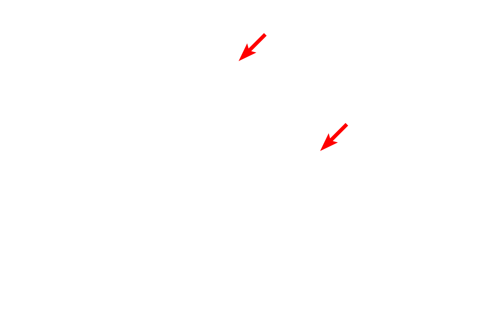  - Red blood cells <p>This electron micrograph shows a podocyte, with its processes contacting three glomerular capillaries.  A primary process of the podocyte branches to form secondary processes called pedicels, which rest on the glomerular basal lamina. Pedicels from one podocyte alternate with those from a different podocyte as they contact the capillary.  Also visible is the fenestrated capillary endothelium.  6000x</p>
